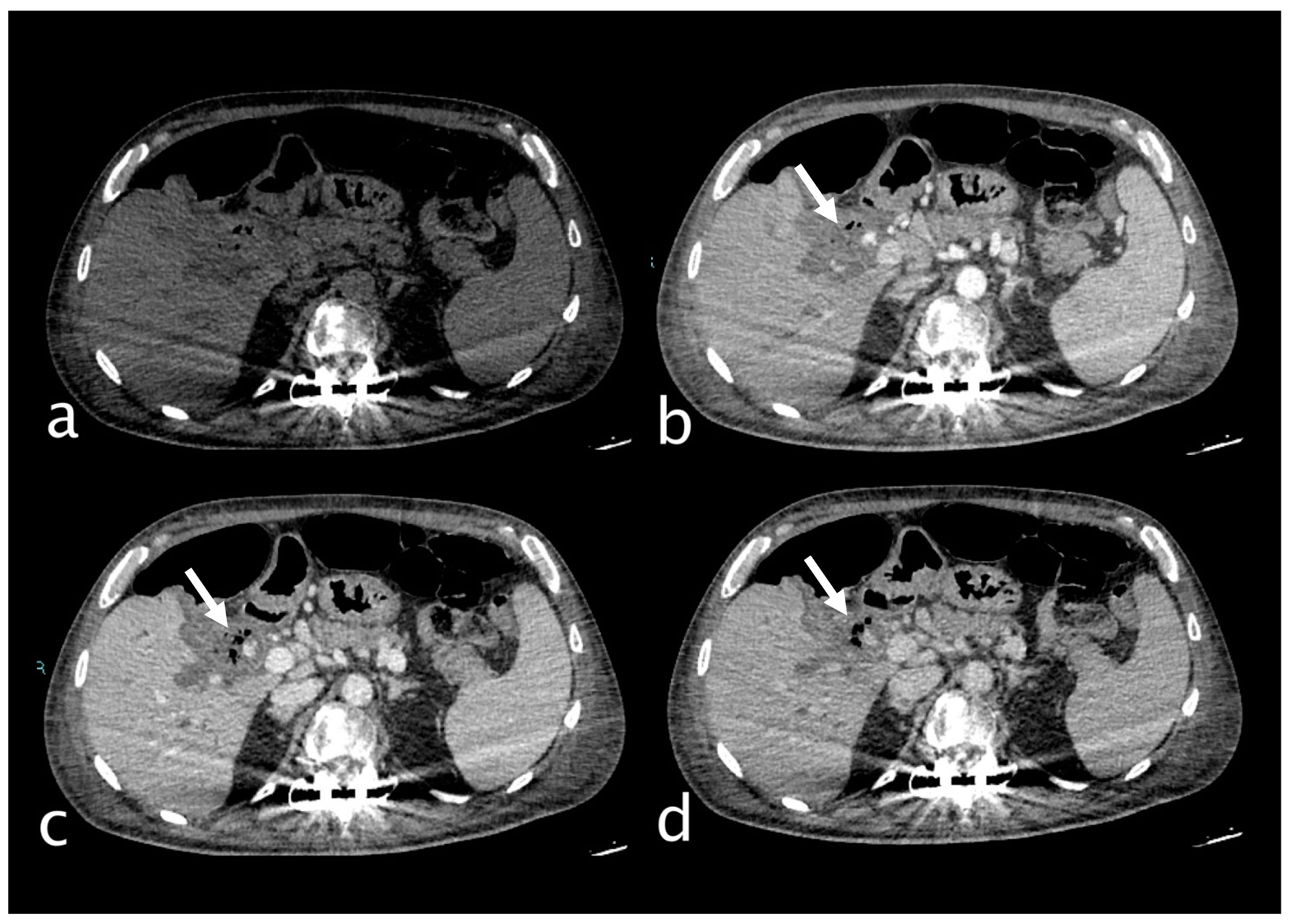 Gastrointestdisord 07 00020 g007