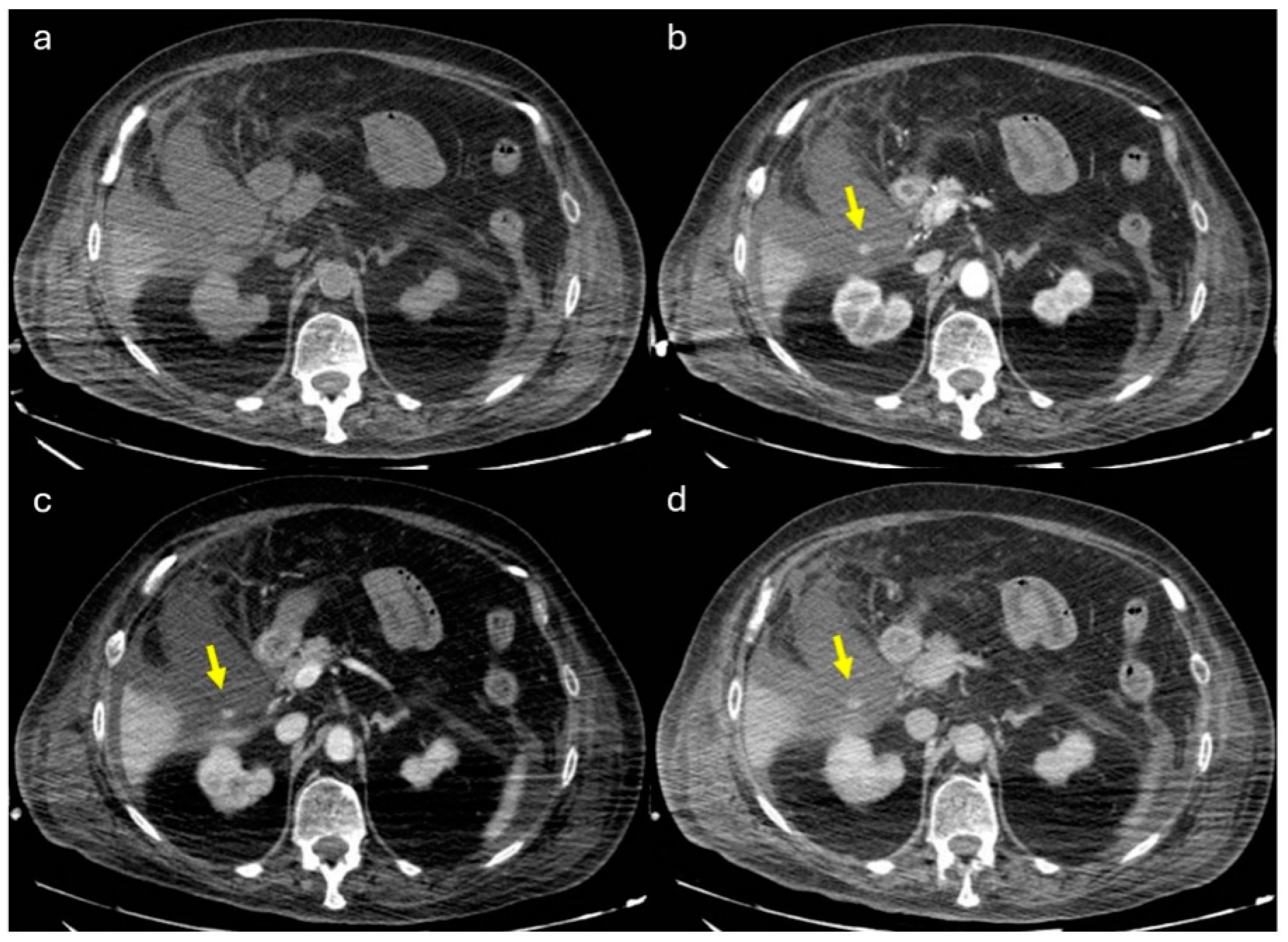 Gastrointestdisord 07 00020 g010