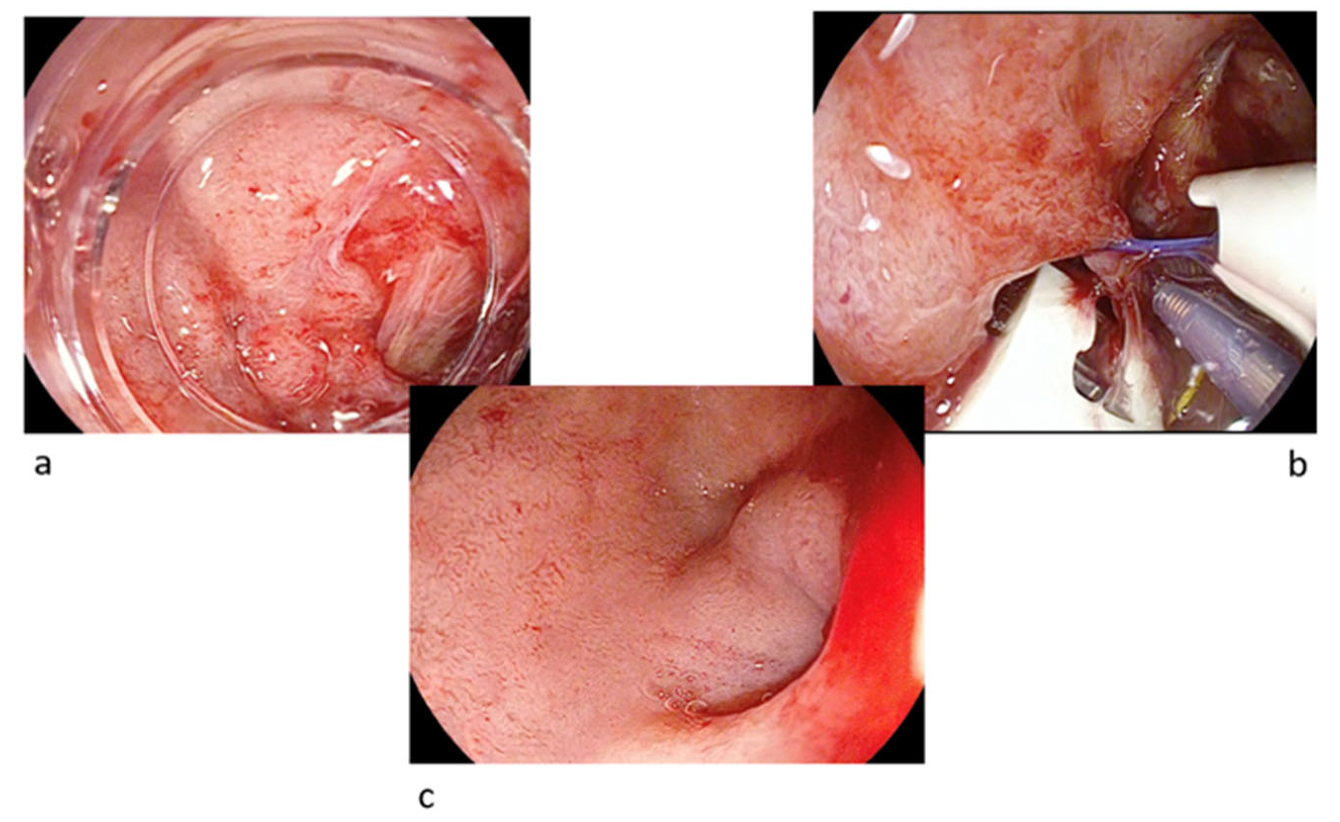 Gastrointestdisord 07 00029 g003
