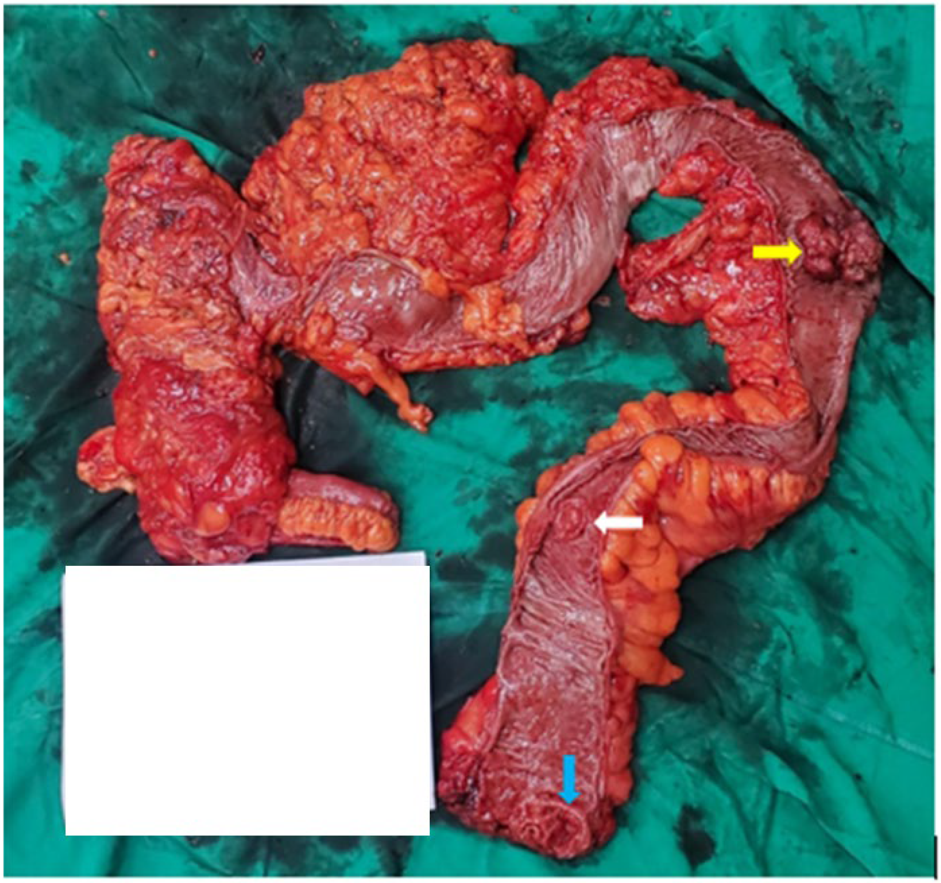 Gastrointestdisord 07 00036 g001