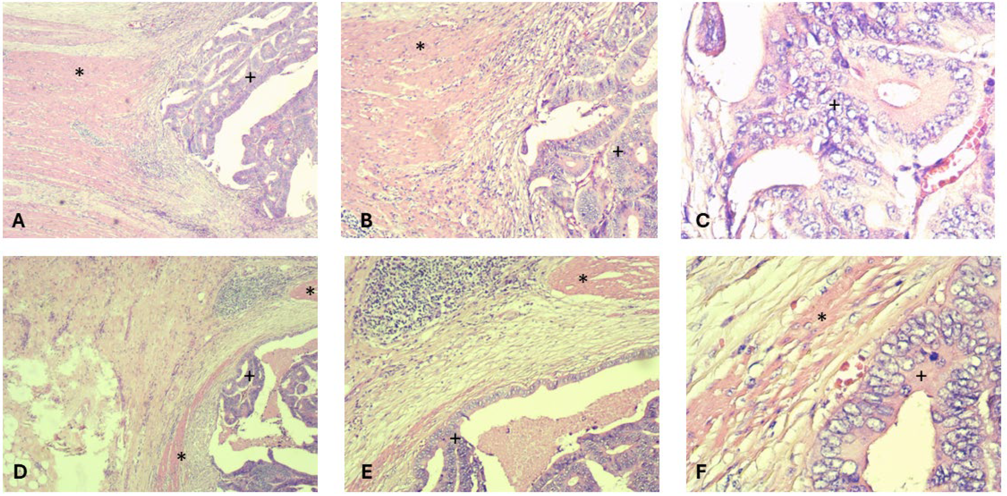 Gastrointestdisord 07 00036 g002