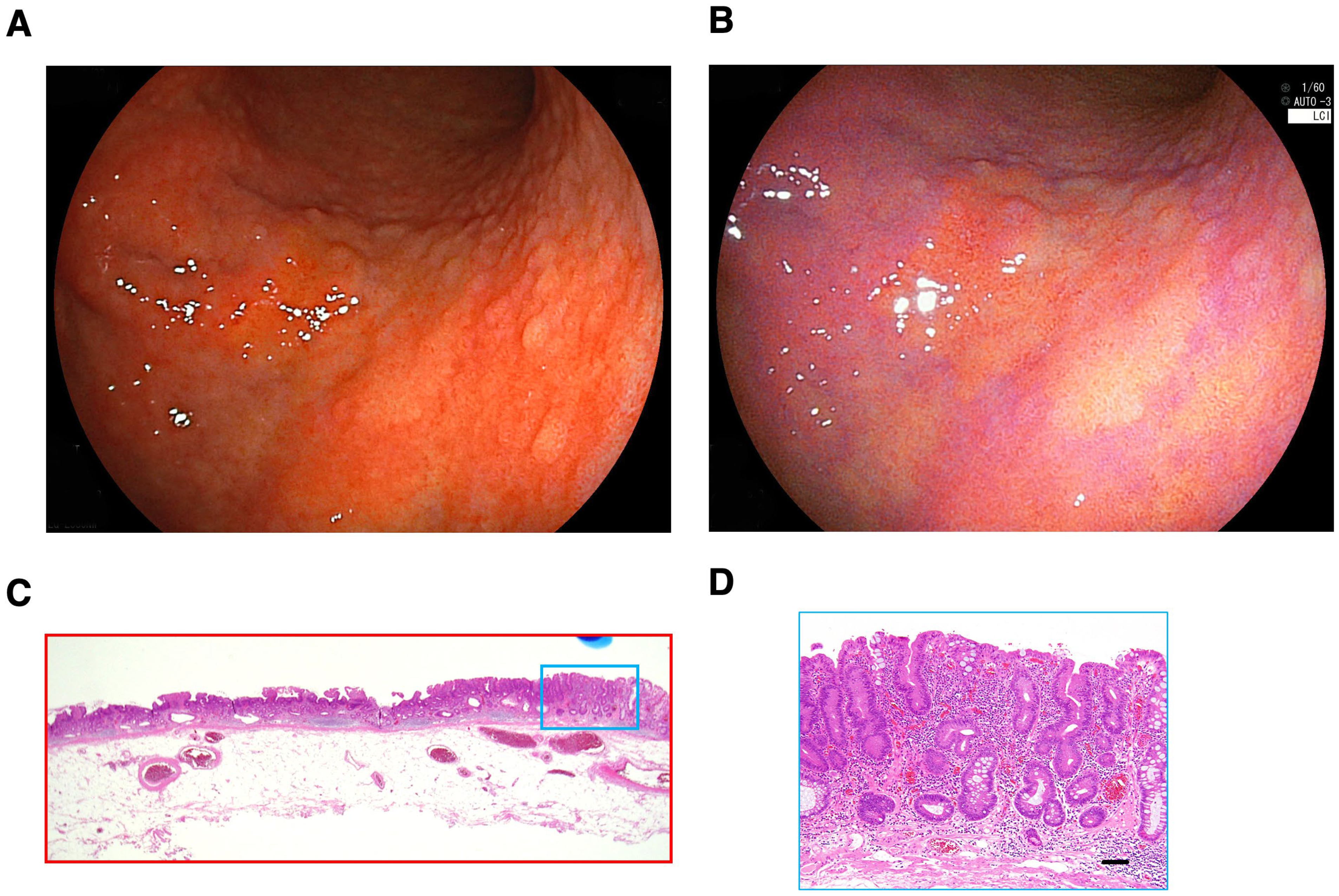 Gastrointestdisord 07 00049 g003