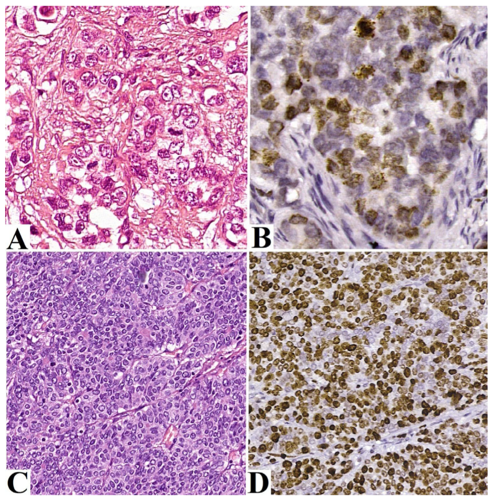 Gastrointestdisord 07 00051 g001