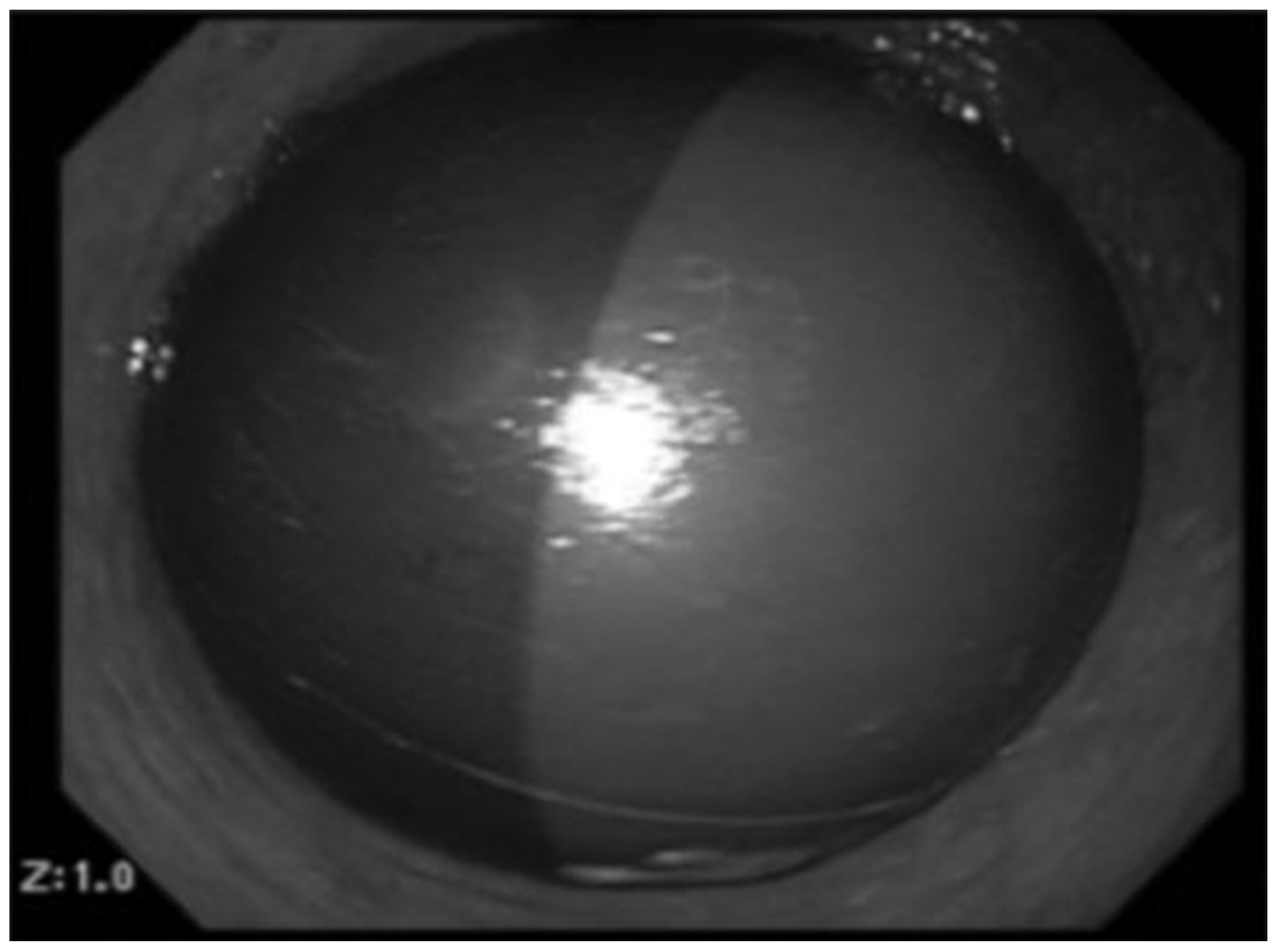 Gastrointestdisord 07 00055 sch001