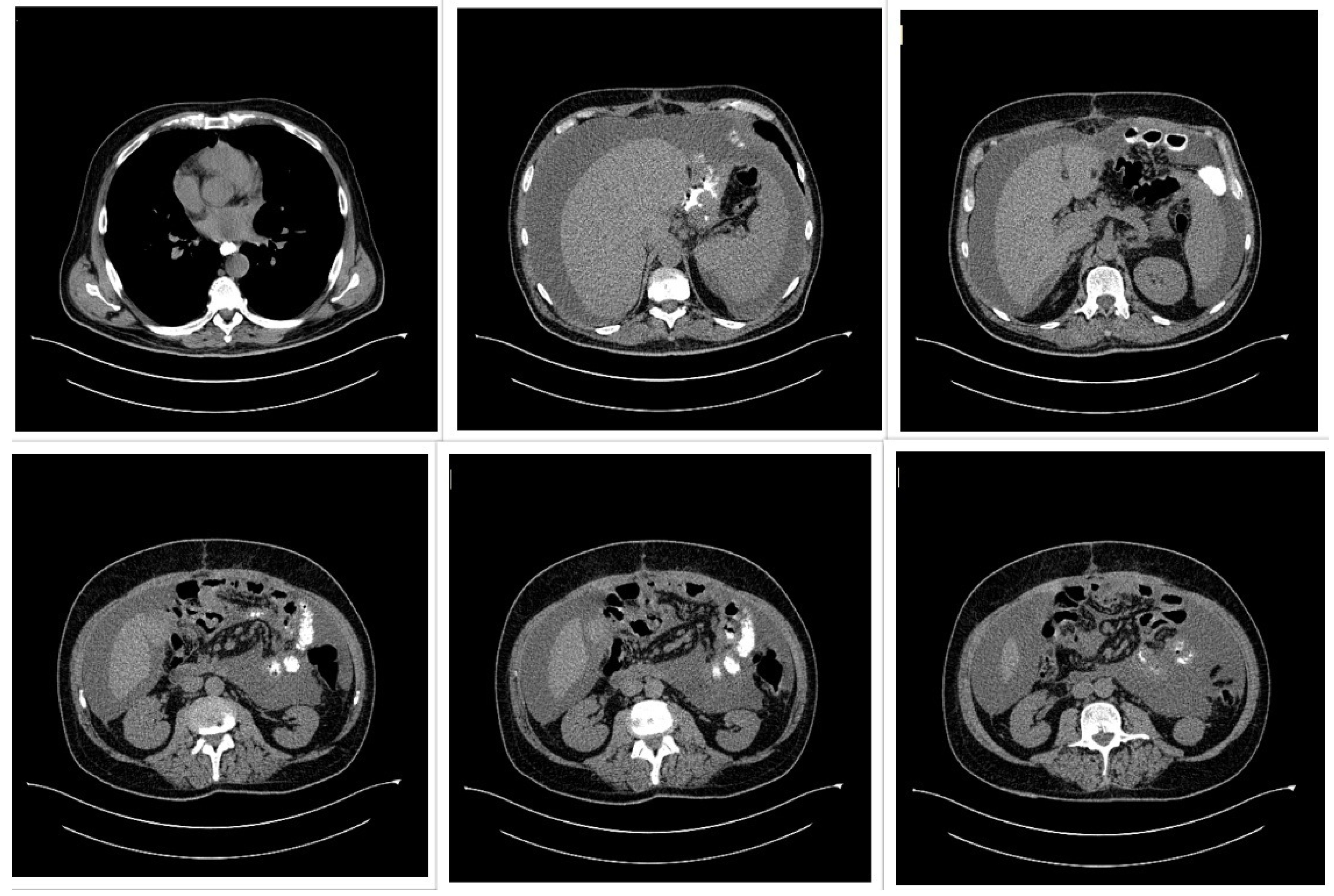 Gastrointestdisord 07 00070 g004
