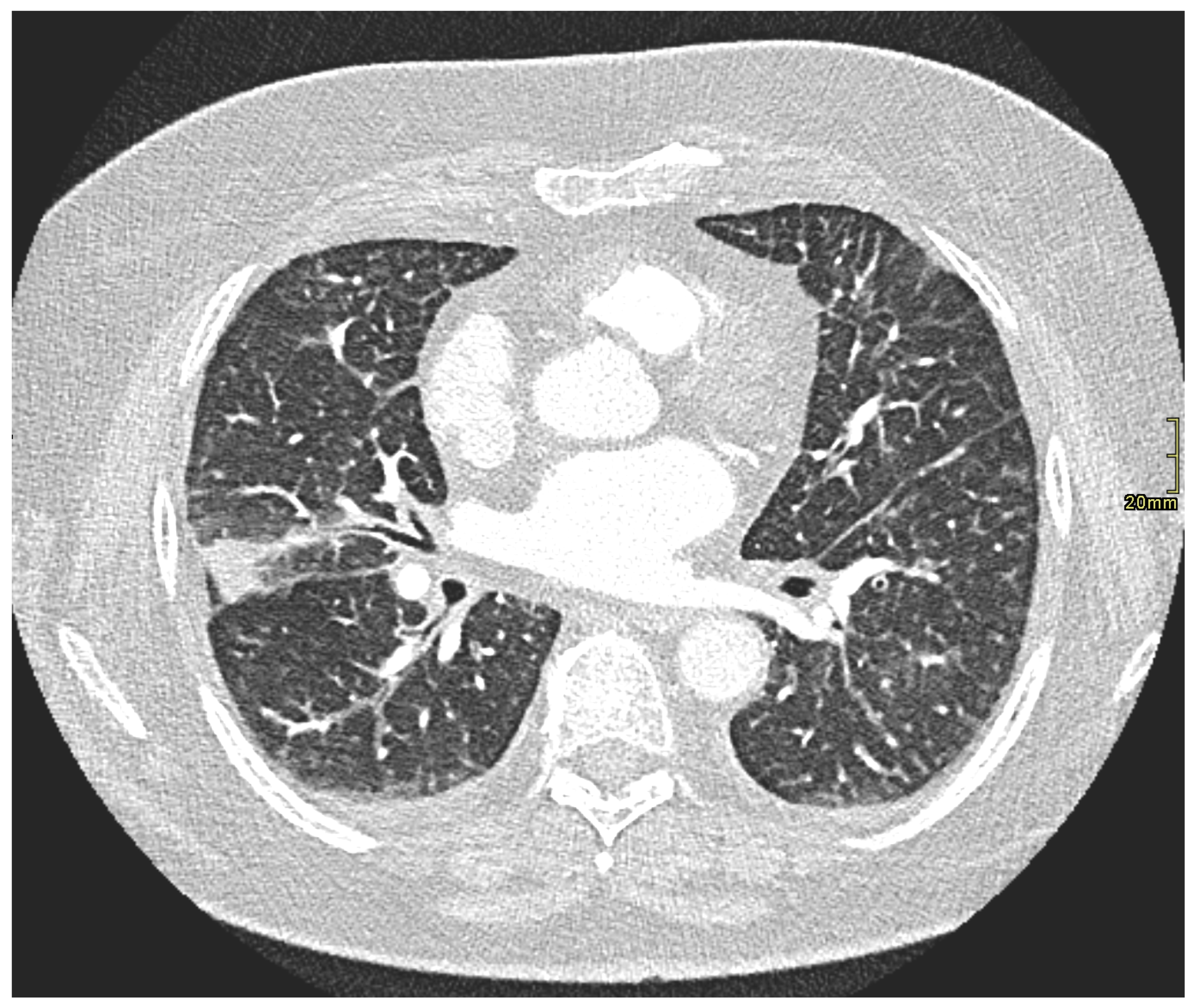 Gastrointestdisord 07 00074 g001