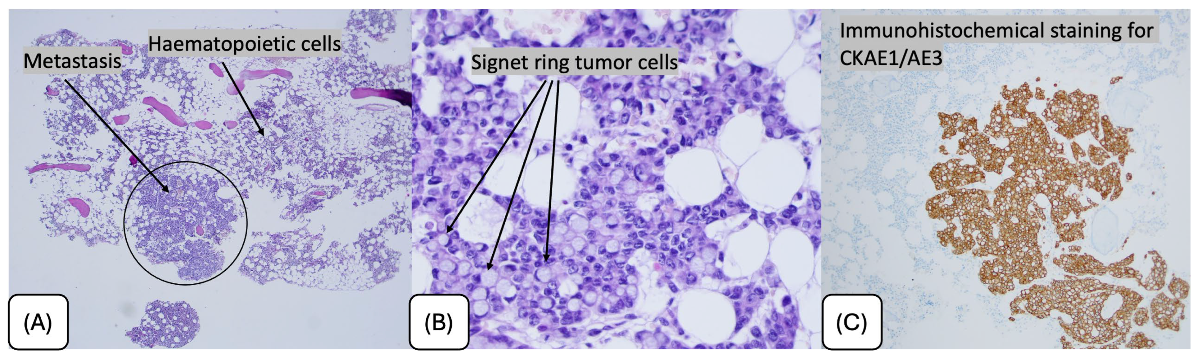 Gastrointestdisord 07 00074 g002