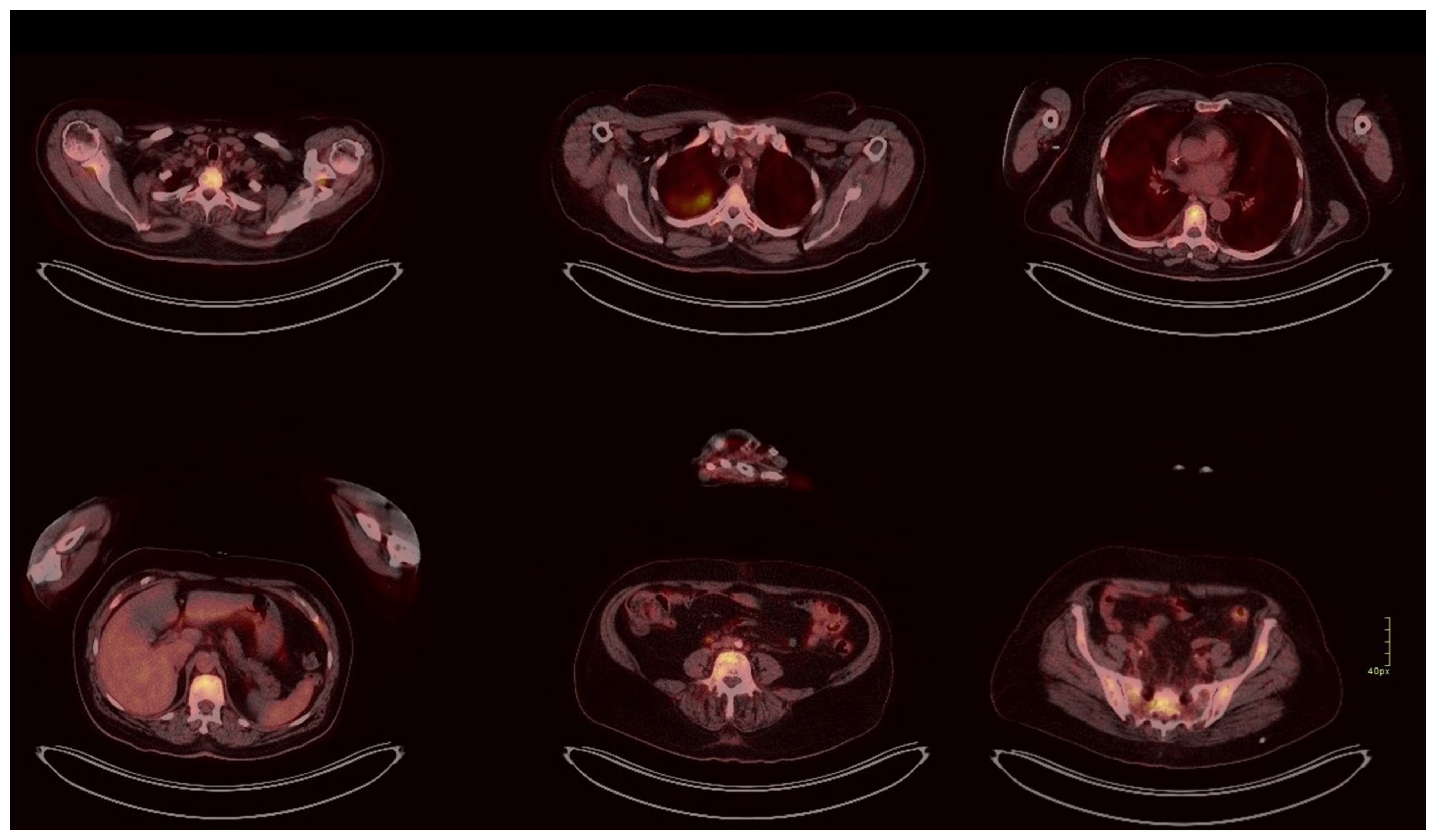 Gastrointestdisord 07 00074 g003