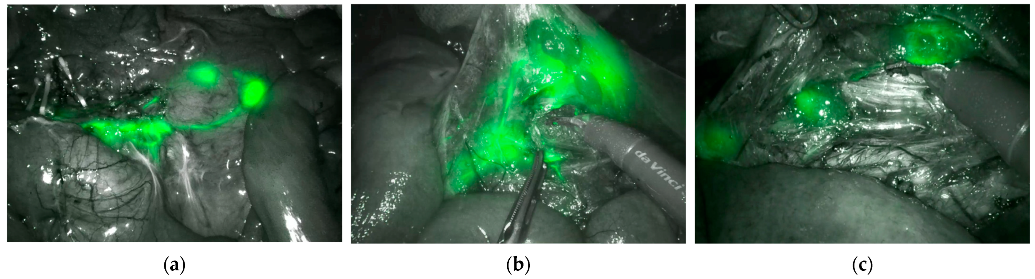 Gastrointestdisord 07 00076 g004