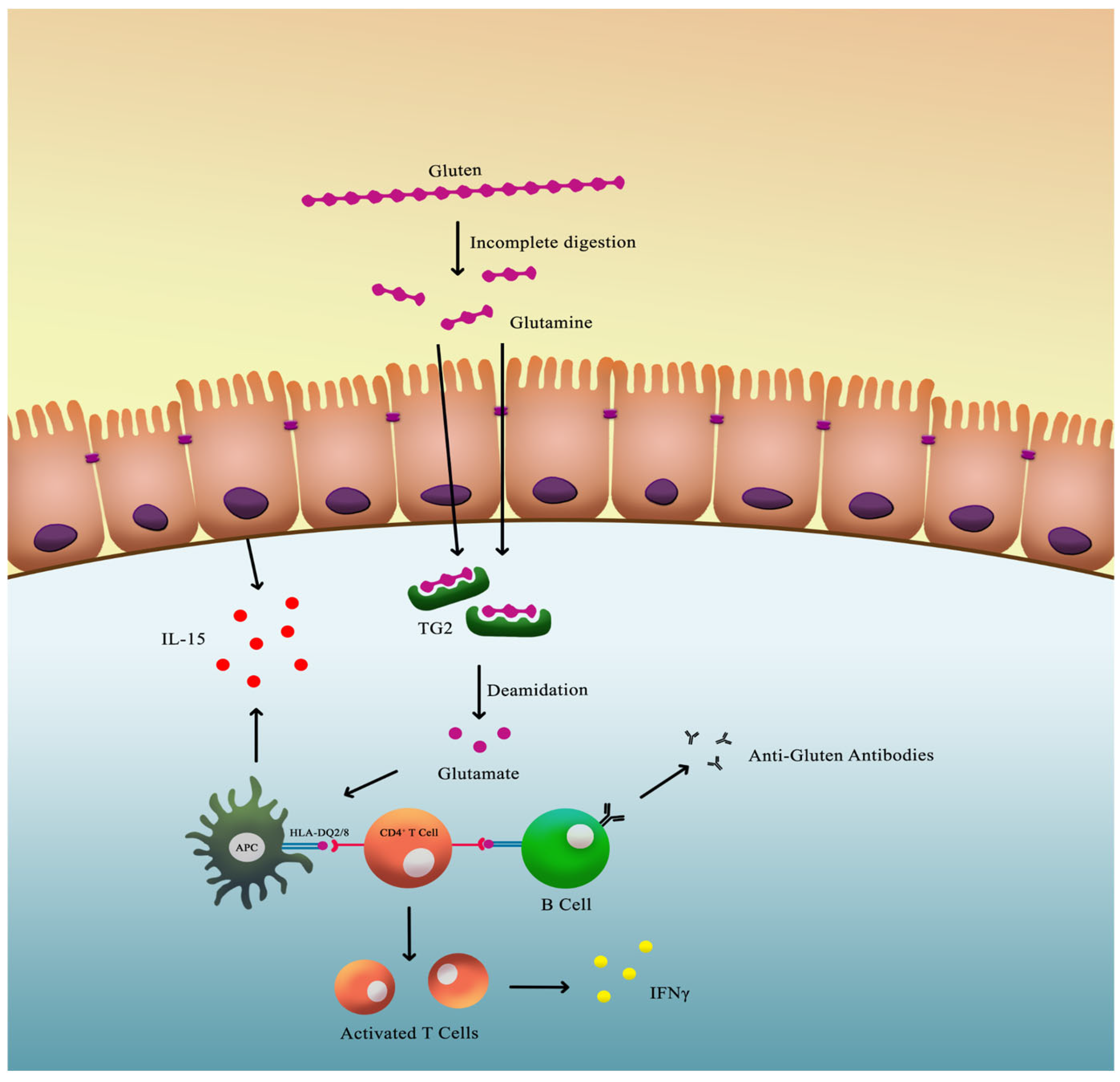 Gastrointestdisord 07 00079 g002
