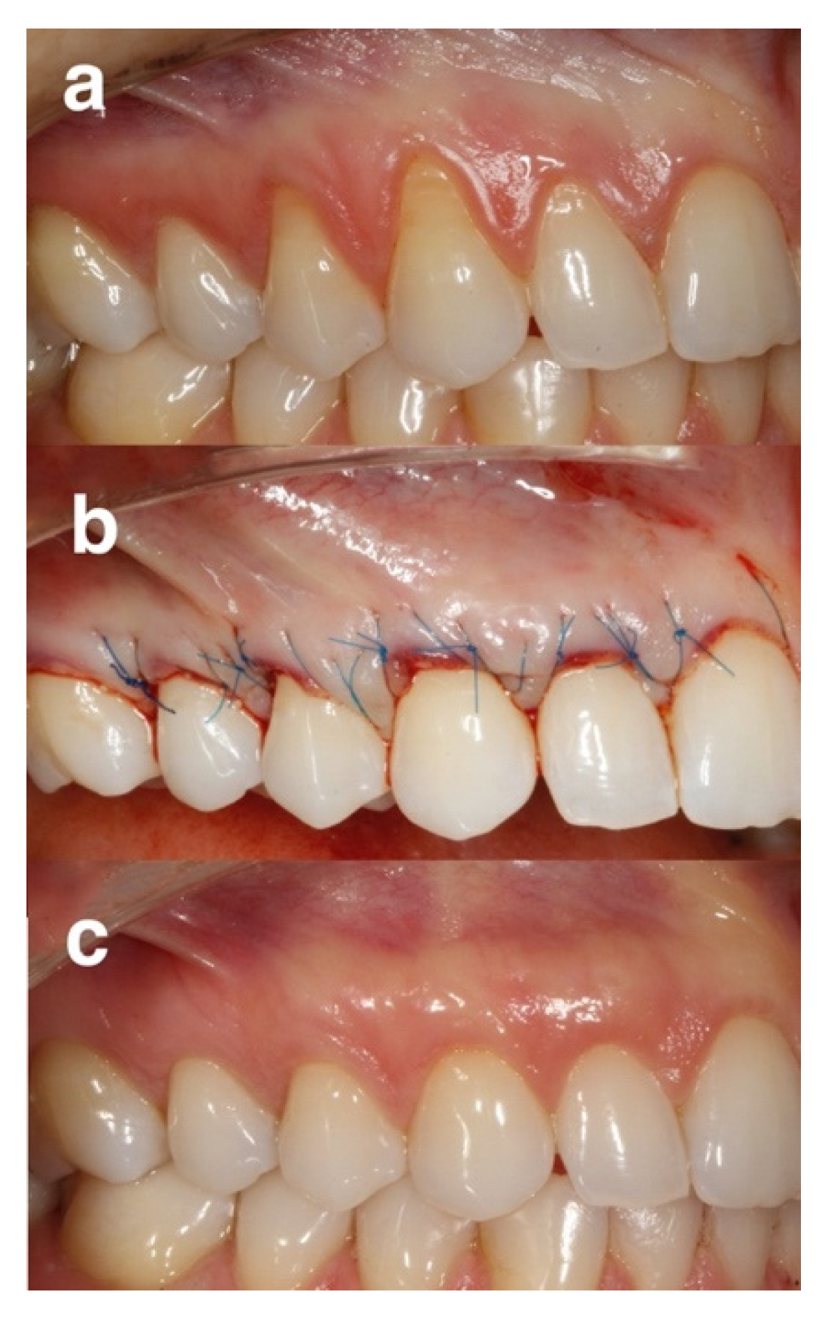 Gels 08 00031 g002 550