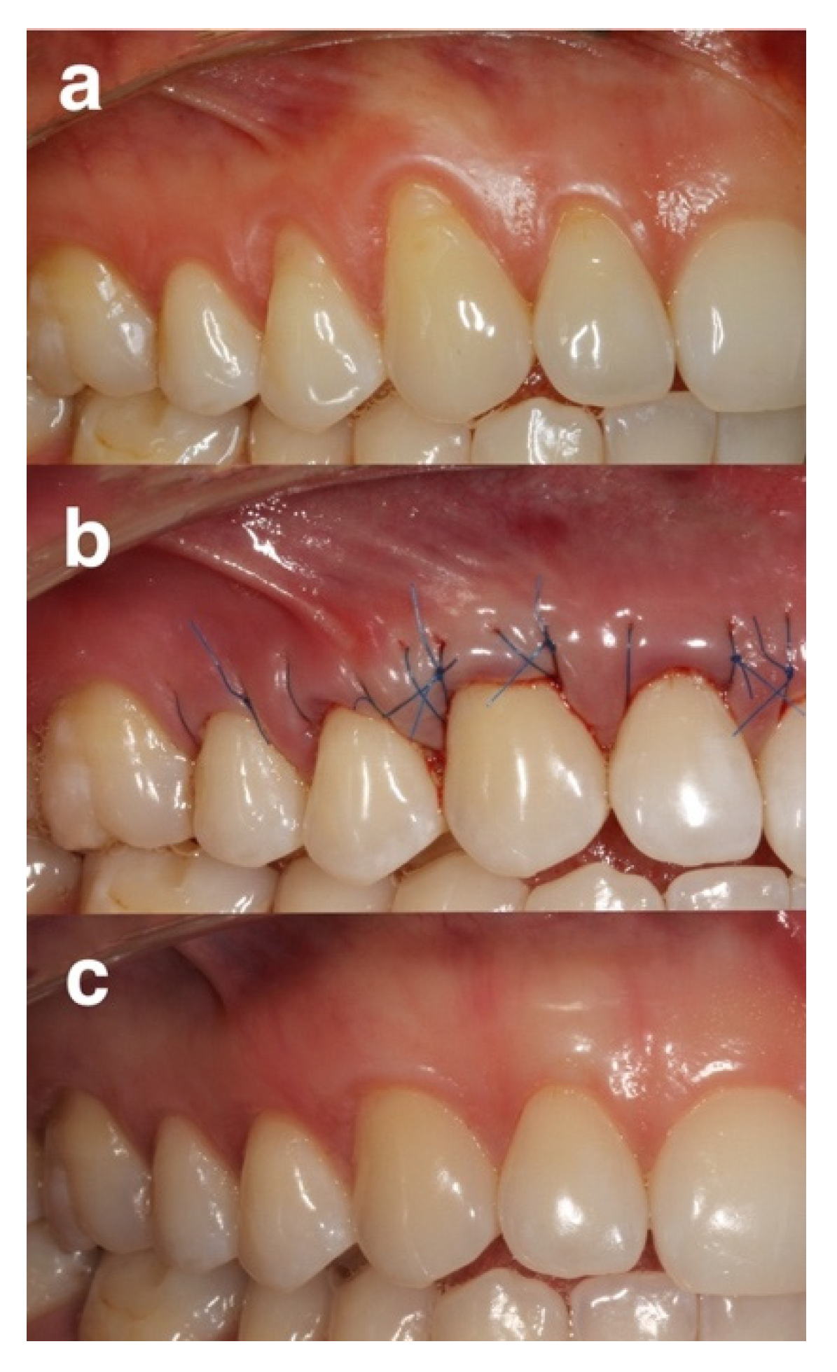 Gels 08 00031 g003 550