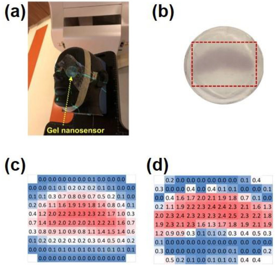 Recent Advances in Hydrogel-Based Sensors Responding to Ionizing