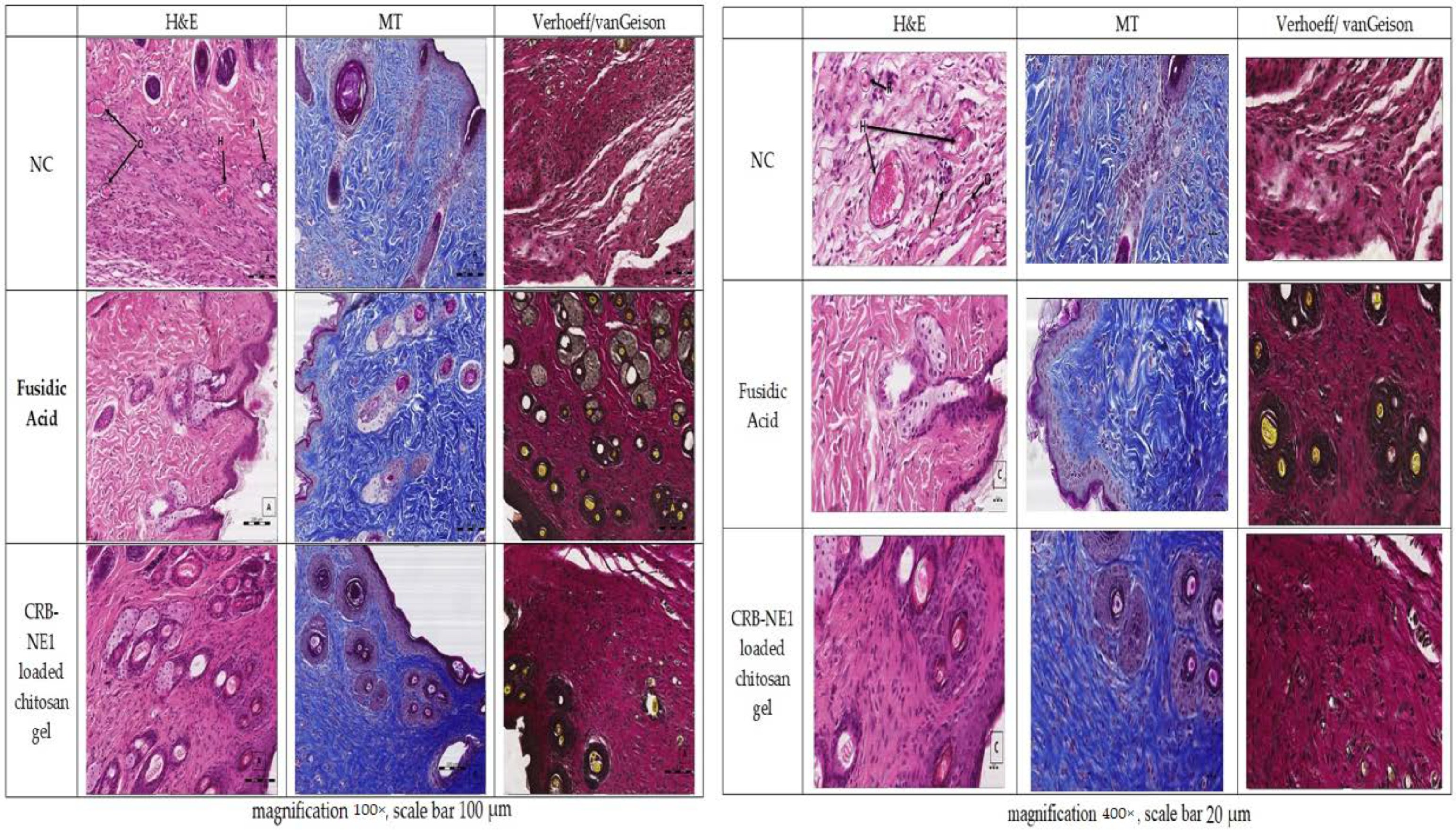 Gels 08 00318 g008 550