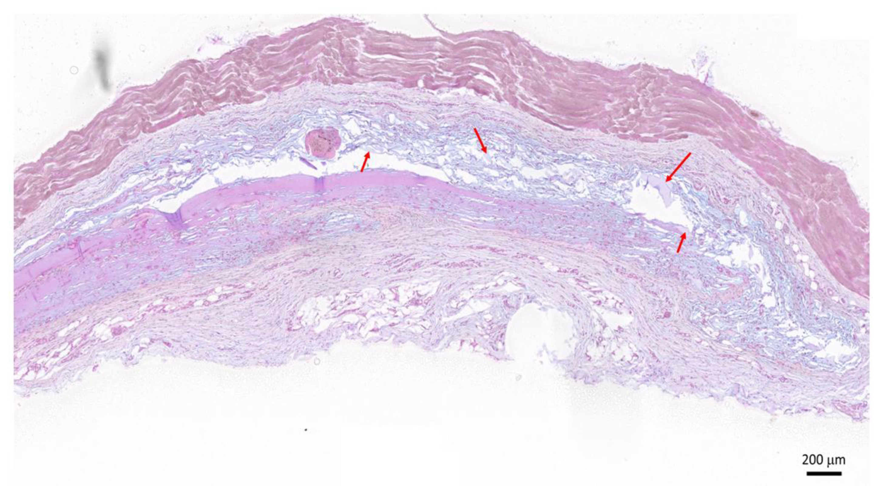 Gels 08 00776 g006 Gels 08 00776 g006