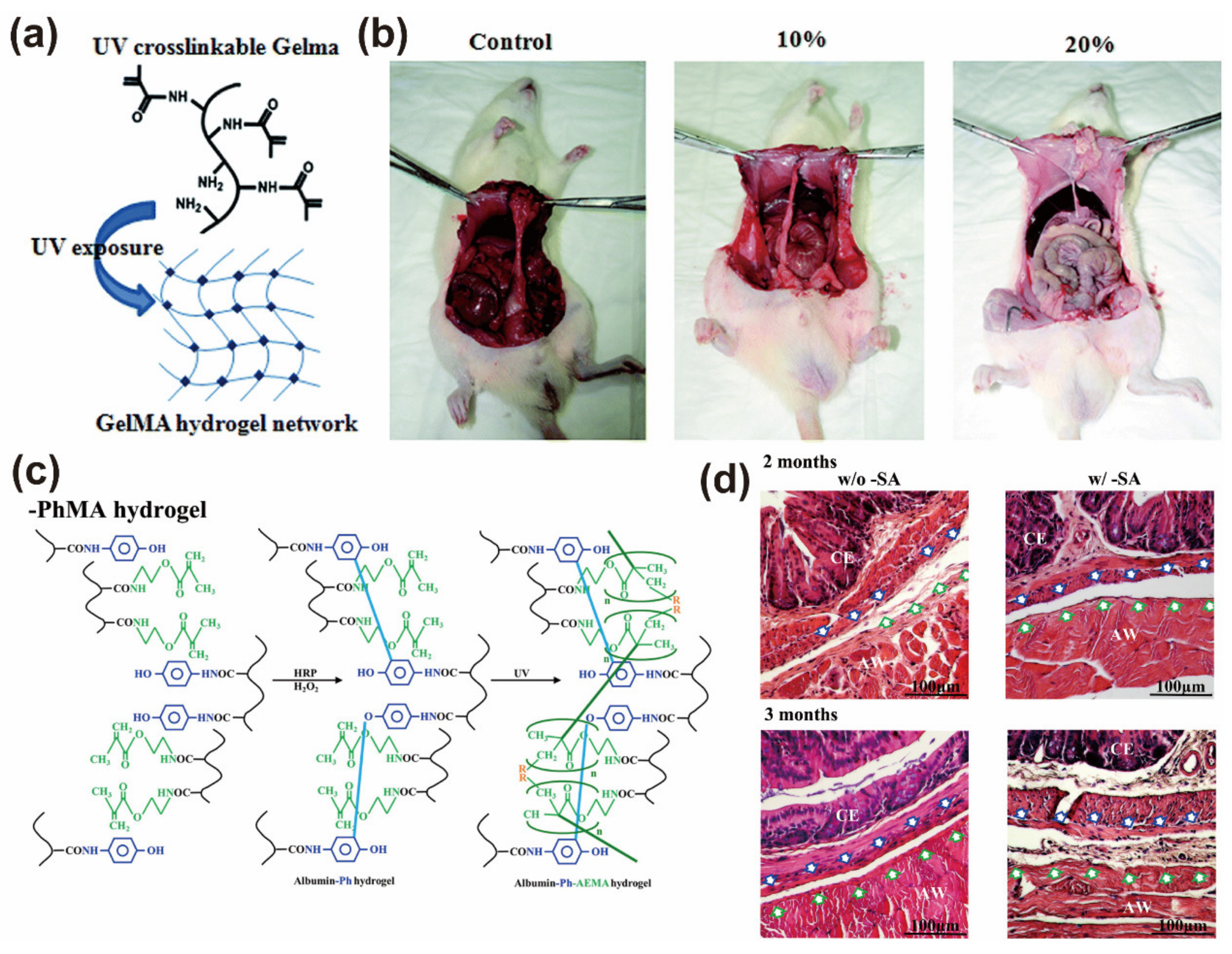 Gels | Free Full-Text | Application of Polymer Hydrogels in the 