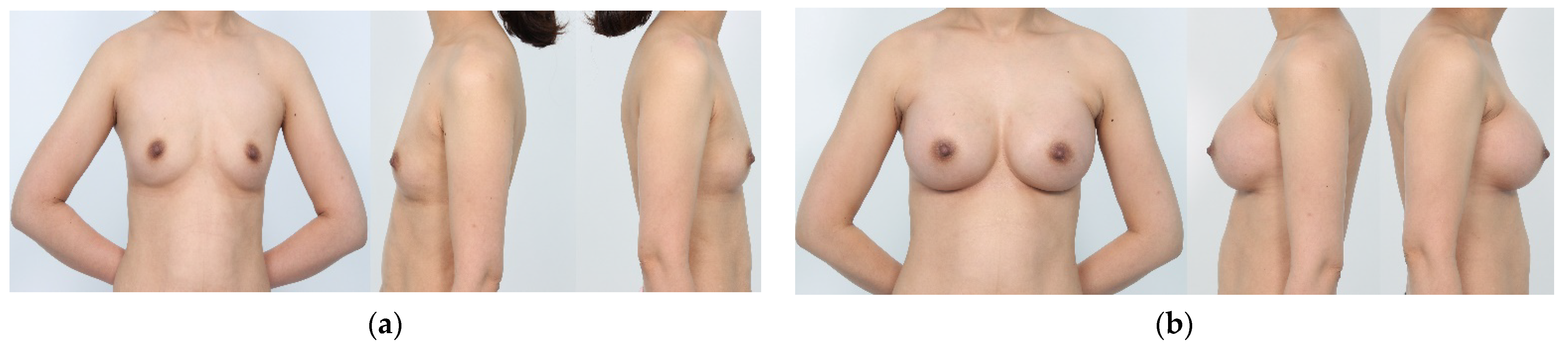 Gels 09 00232 g004 Gels 09 00232 g004