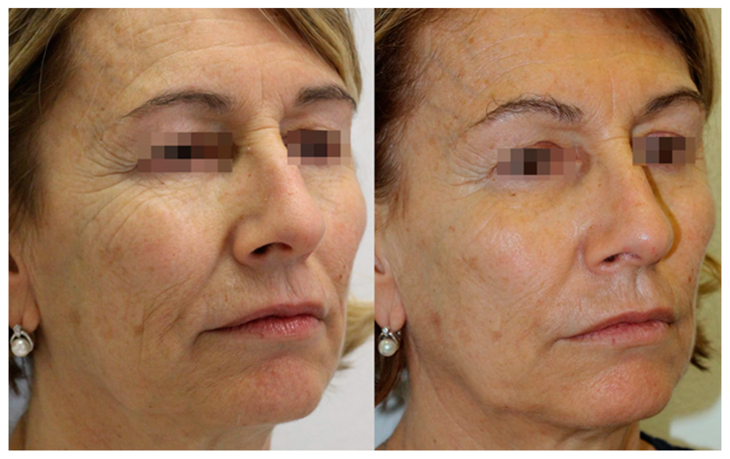 Gels 09 00614 g004 Gels 09 00614 g004