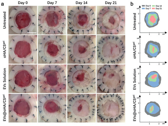 Beyond Traditional Medicine: EVs-Loaded Hydrogels as a Game Beyond Traditional Medicine: EVs-Loaded Hydrogels as a Game