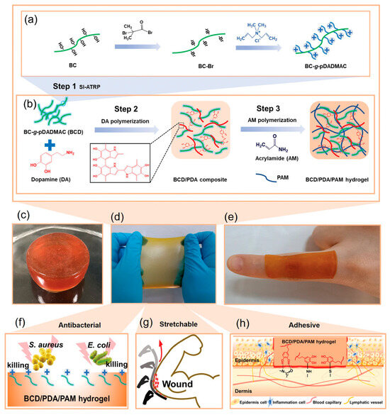Antibacterial Hydrogels for Wound Dressing Applications