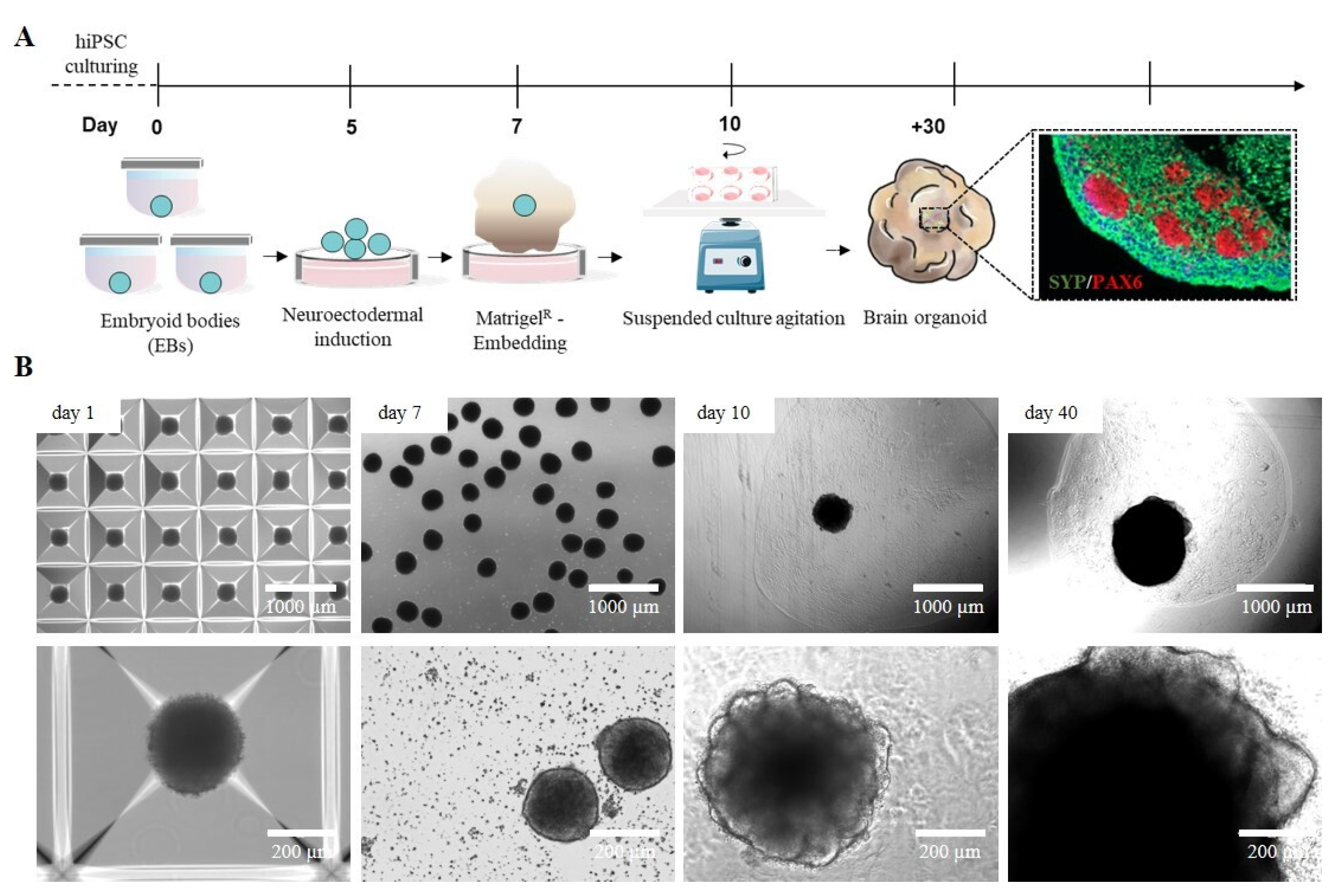 Three-Dimensional-Bioprinted Embedded-Based Cerebral