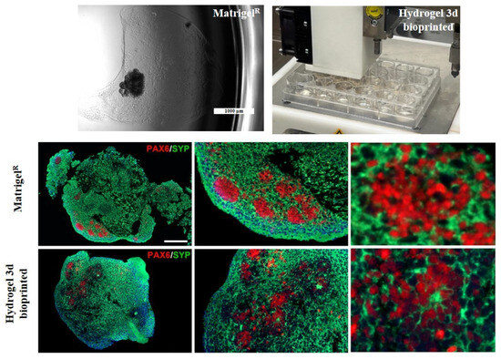 ソフト Three-Dimensional-Bioprinted Embedded-Based Cerebral