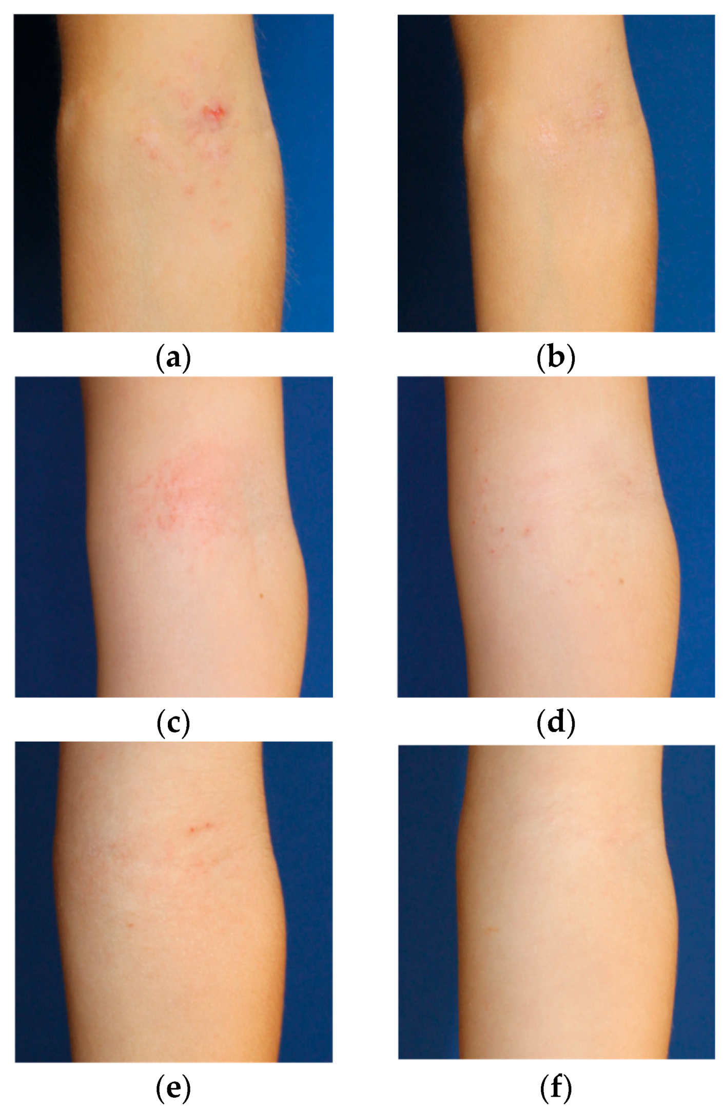 Gels 11 00880 g003 Gels 11 00880 g003