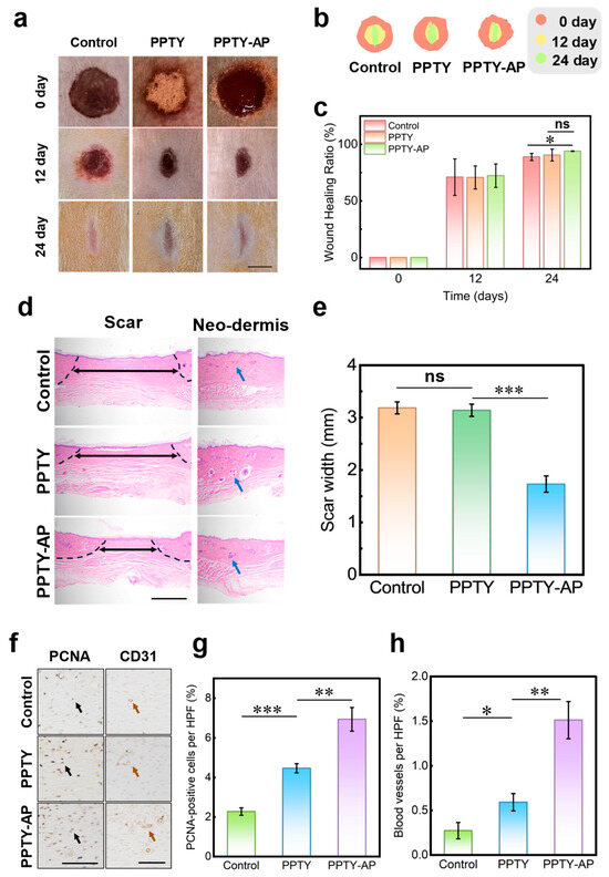 A Multifunctional Shape-Adaptive Bilayer Hydrogel for Acute Hemostasis ...