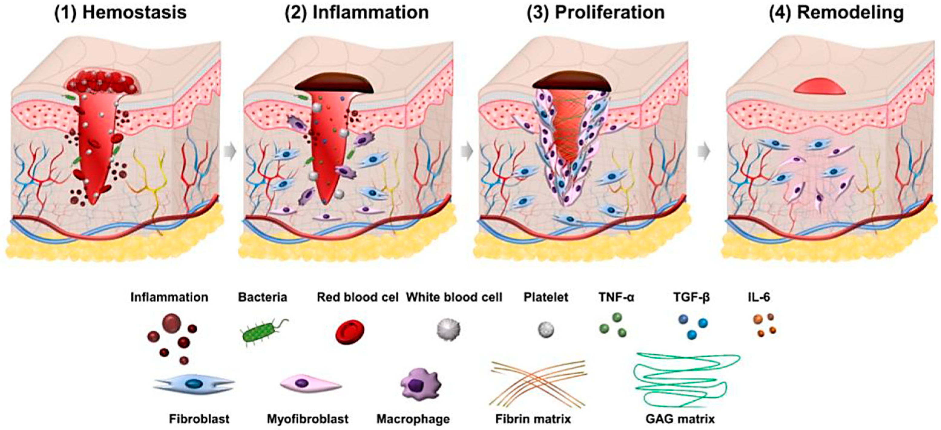Hyaluronic Acid-Based Biomaterials for Soft Tissue Repair and