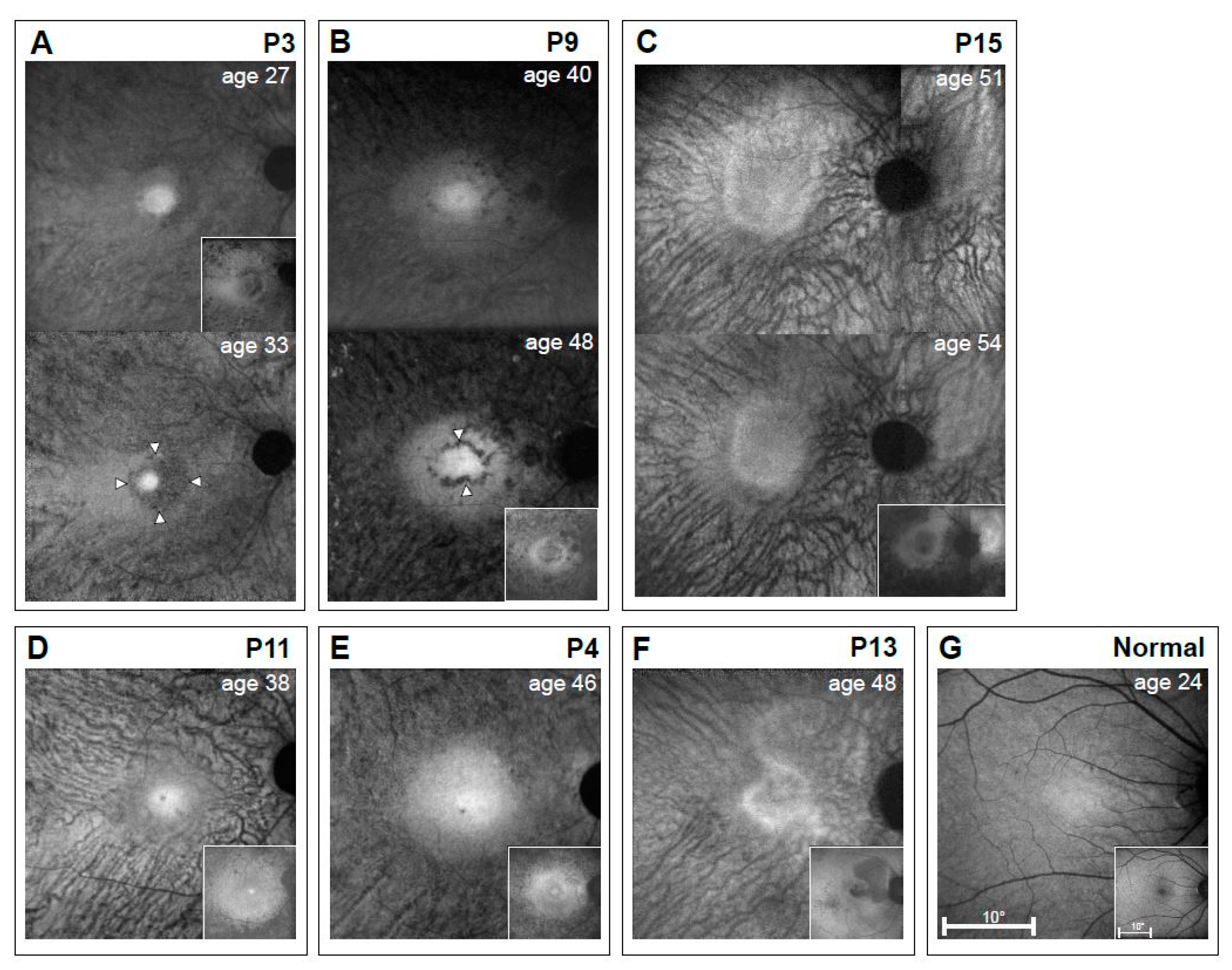 Genes 08 00178 g006 Genes 08 00178 g006