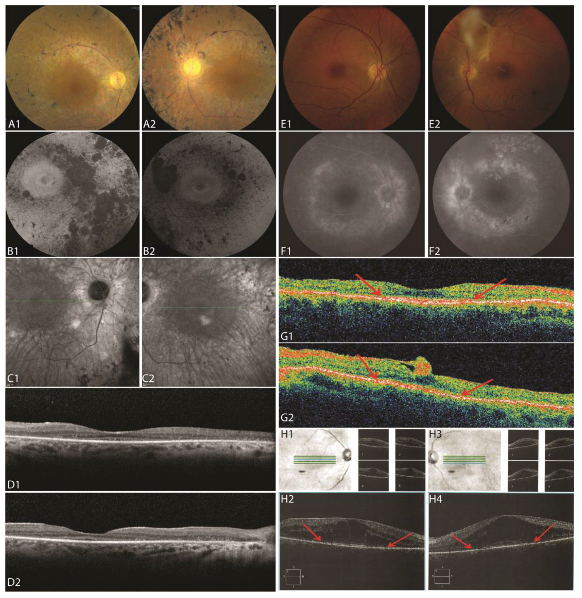 Genes 08 00210 g003 Genes 08 00210 g003
