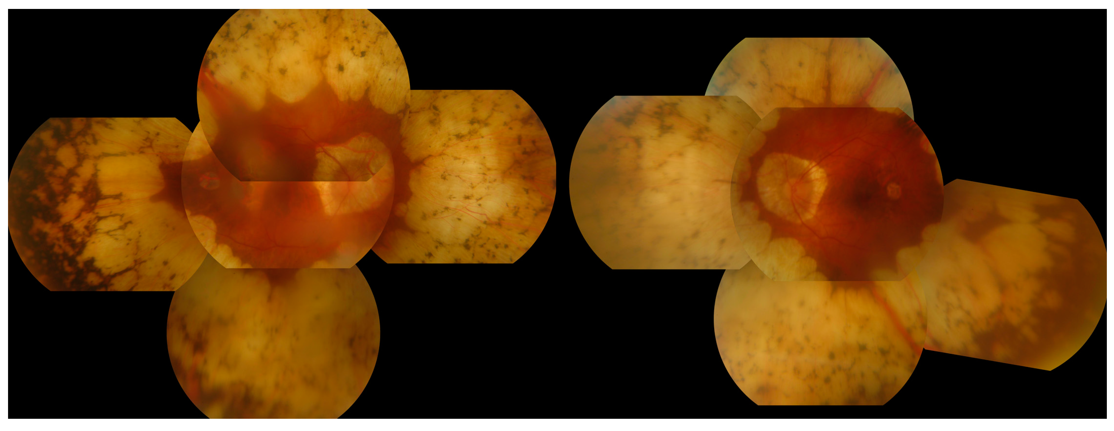 Genes 08 00304 g009