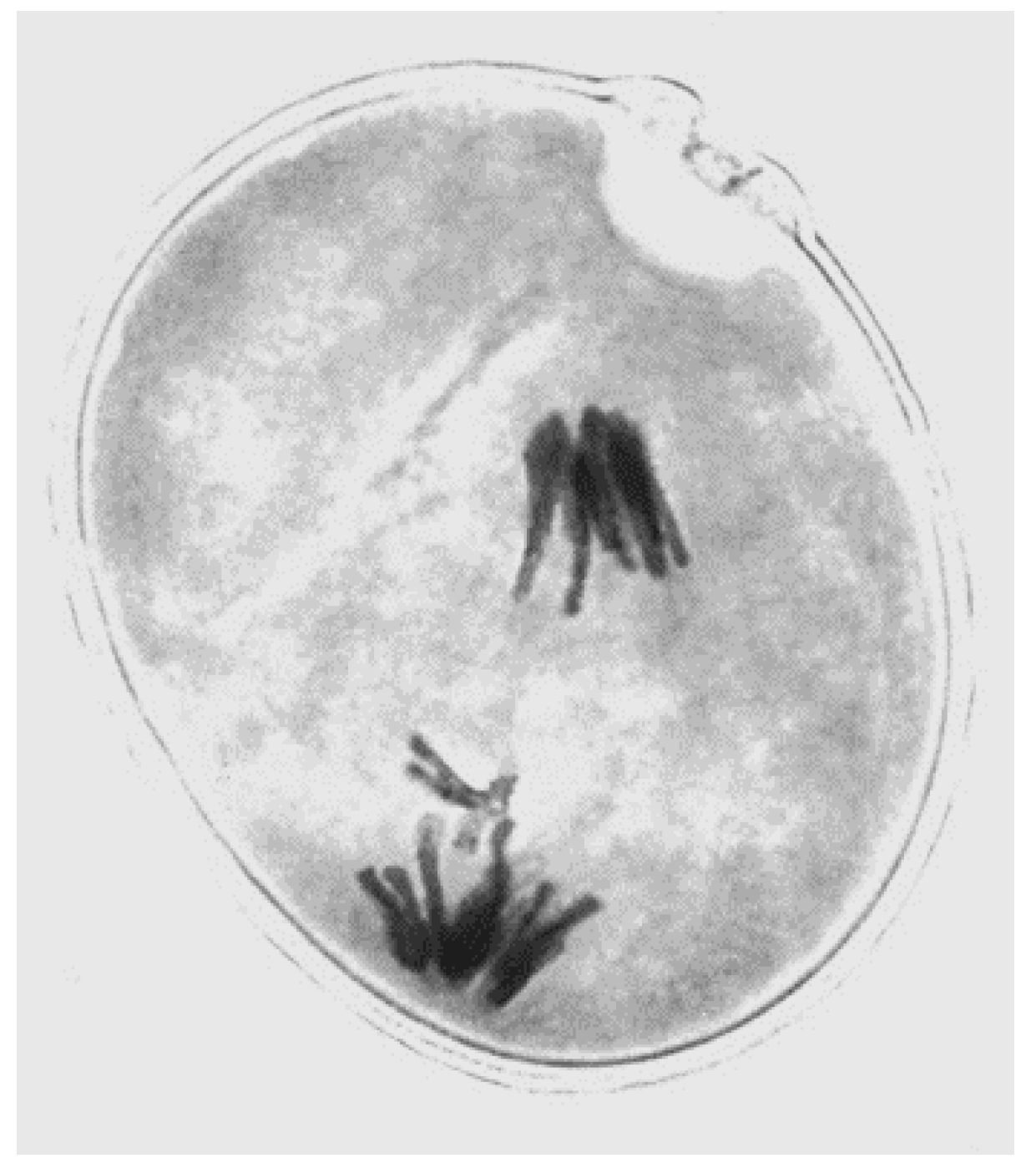  Draw A Sketch Of How Nondisjunction Occurs During Meiosis for Beginner