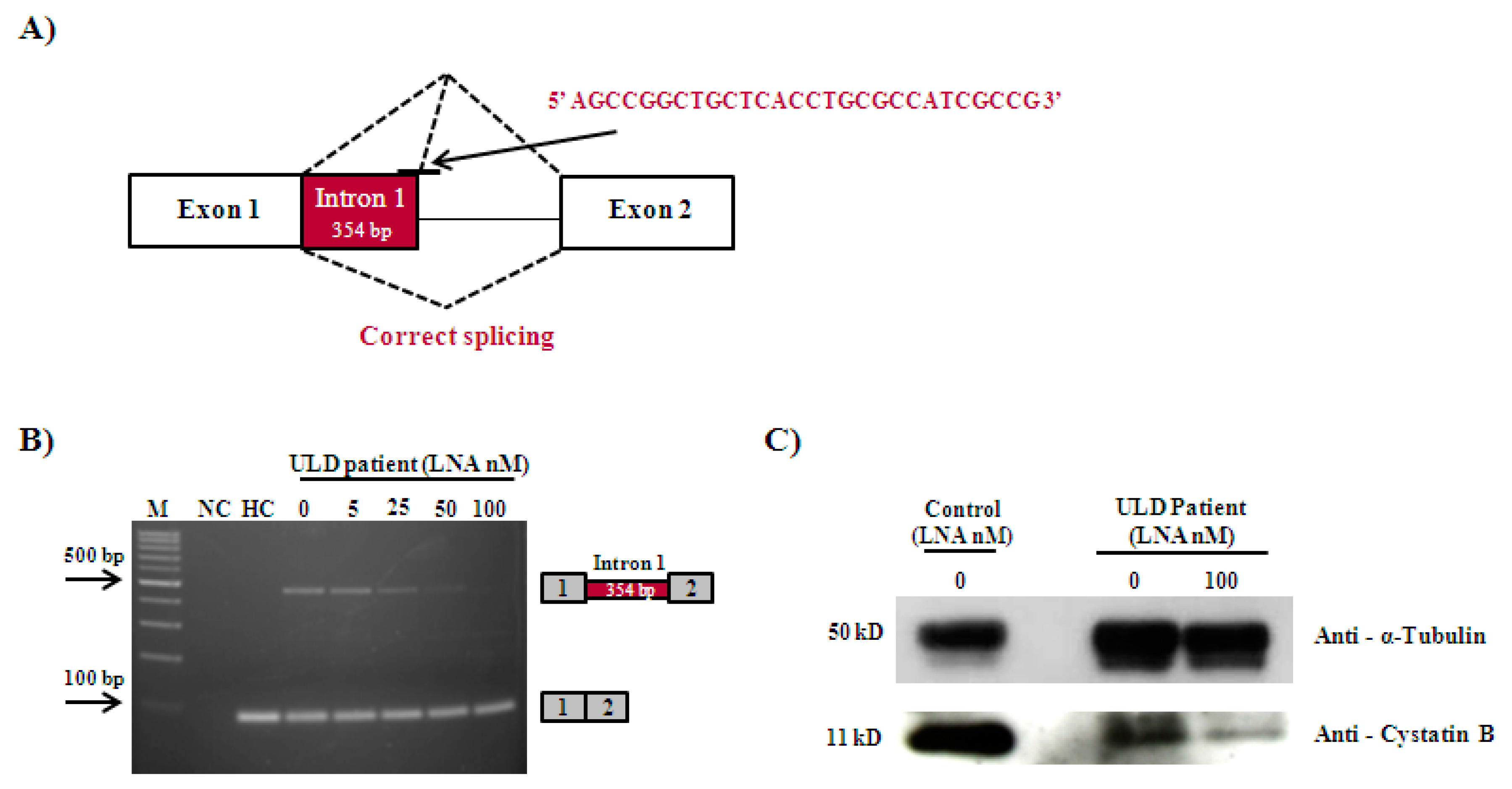 Genes | Free Full-Text | Correction of a Splicing Mutation Affecting an