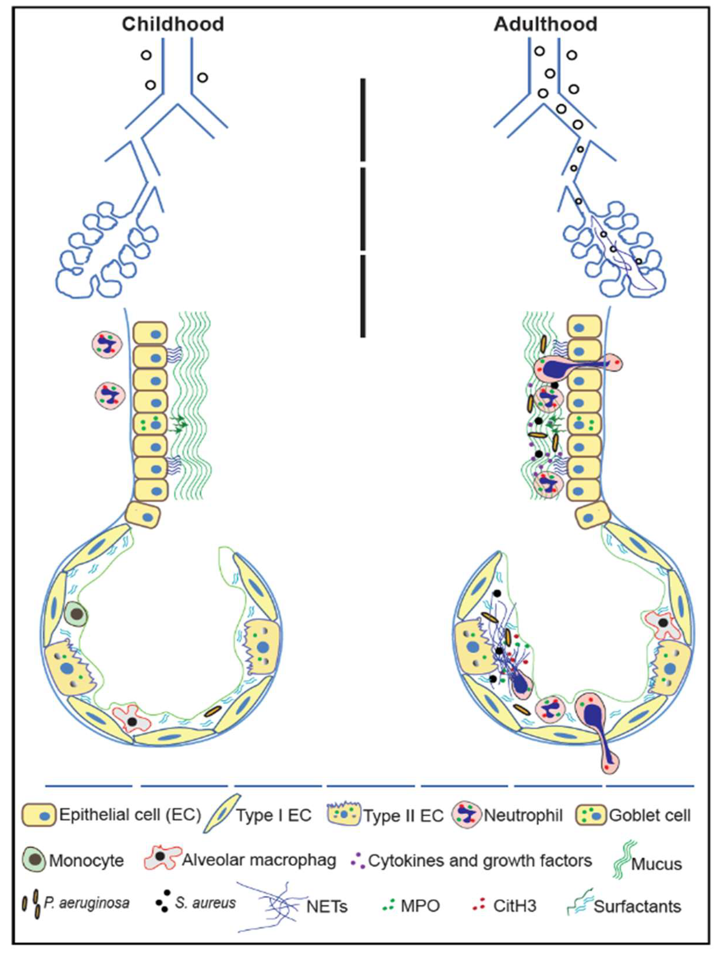 Genes Free Full Text Progression Of Cystic Fibrosis Lung Disease From Childhood To Adulthood Neutrophils Neutrophil Extracellular Trap Net Formation And Net Degradation Genes Free Full Text Progression Of Cystic Fibrosis Lung Disease From Childhood To Adulthood Neutrophils Neutrophil Extracellular Trap Net Formation And Net Degradation