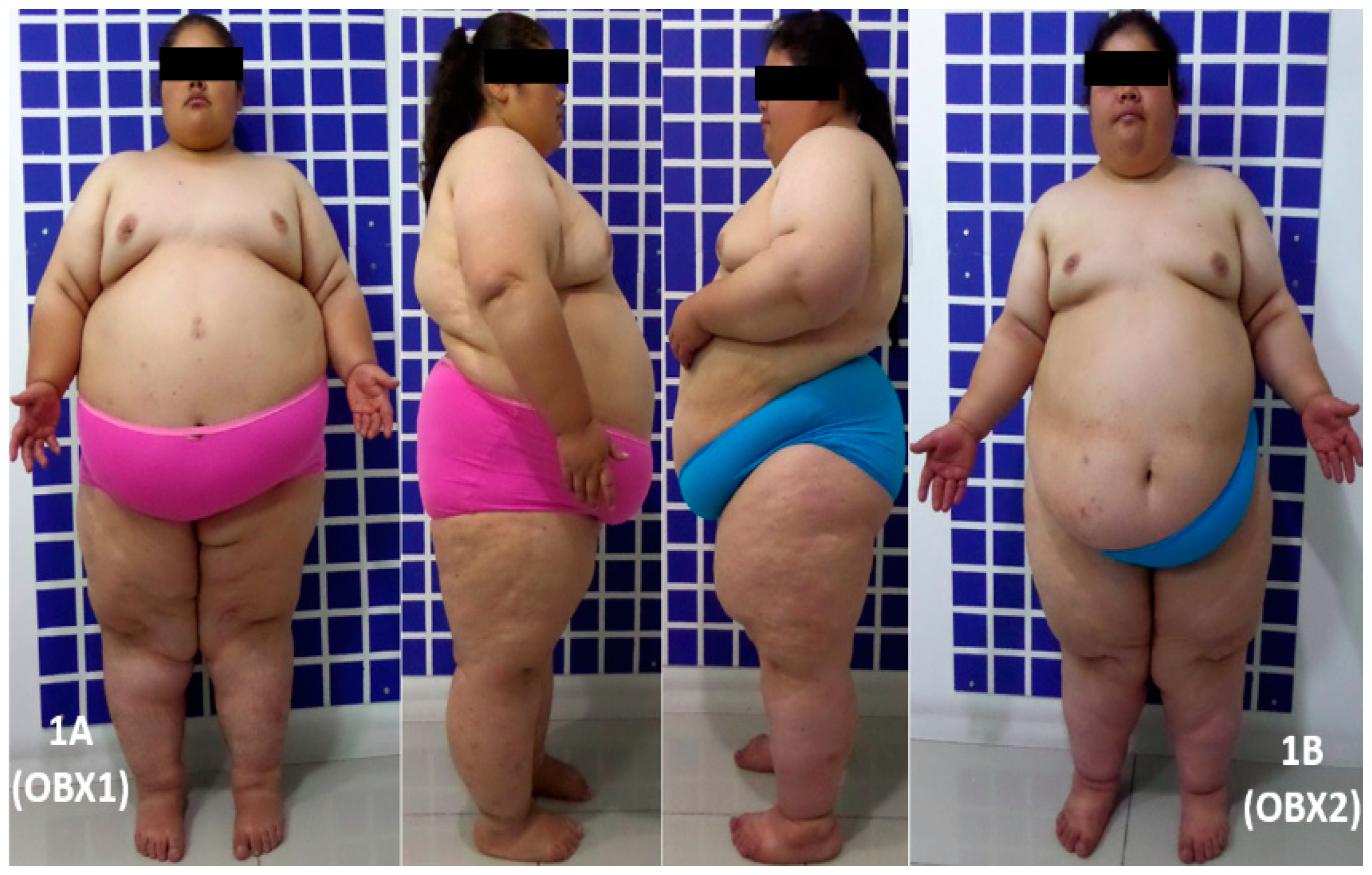 Genes 10 00342 g001
