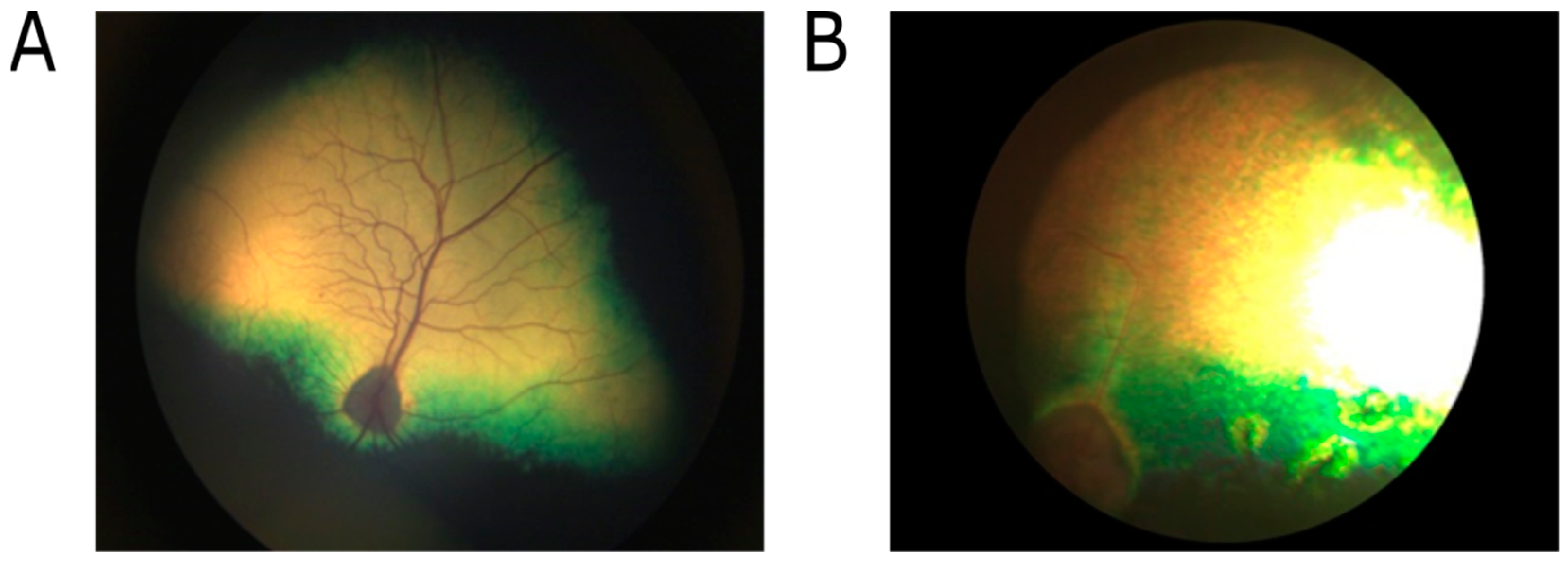 Genes | Free Full-Text | Whole Genome Sequencing of Giant