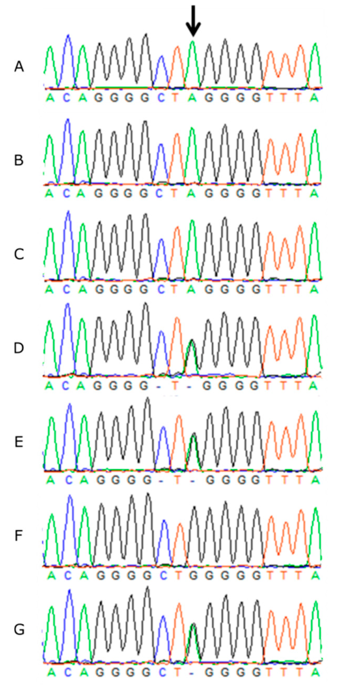 Genes | Free Full-Text | Whole Genome Sequencing of Giant