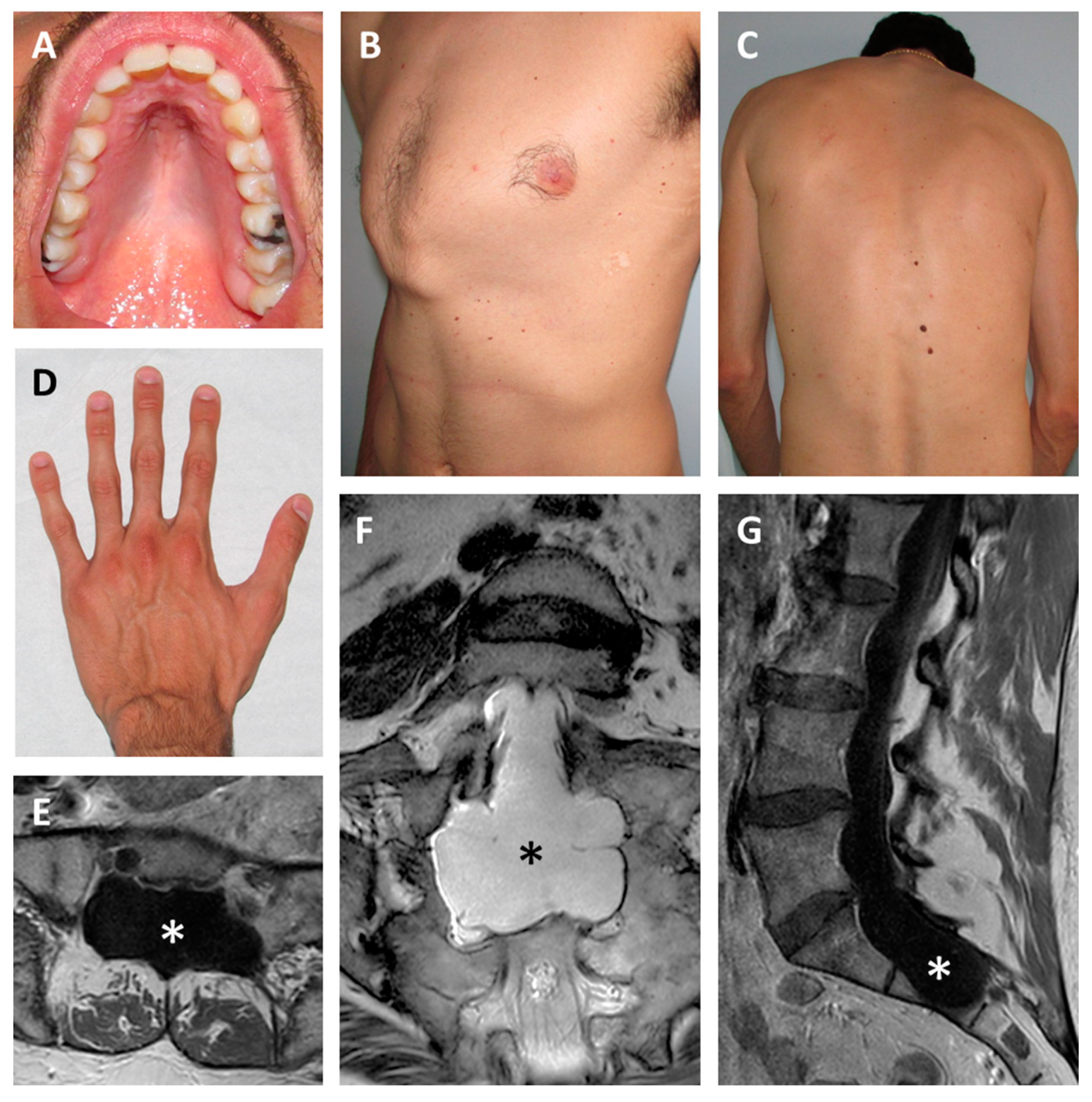 Genes 10 00442 g001 Genes 10 00442 g001