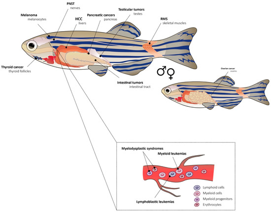 Genes | Free Full-Text | Zebrafish Models of Cancer—New Insights on