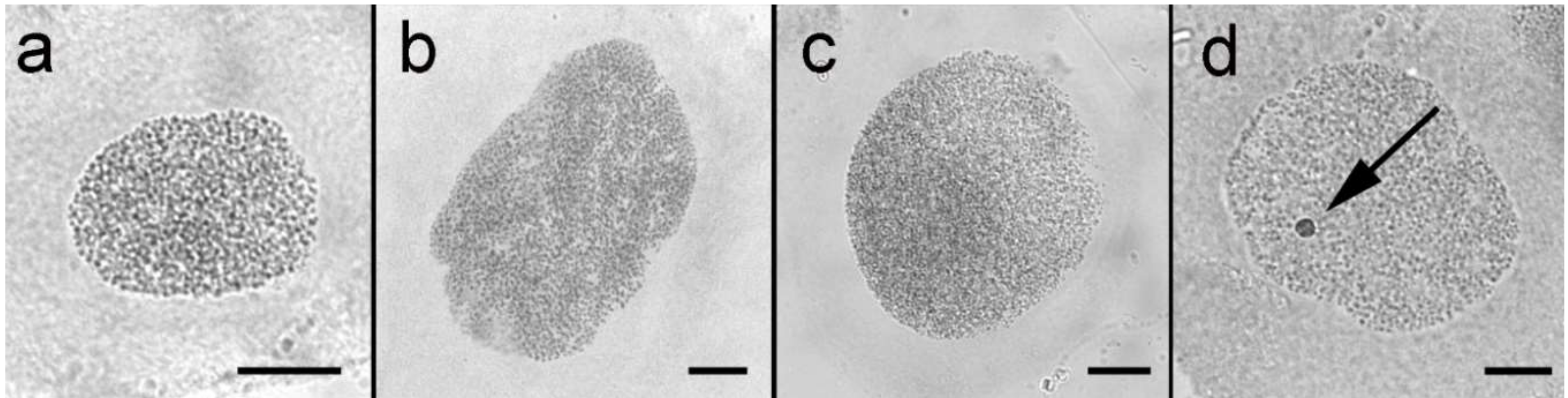 chromatin negative nuclei chromatin negative nuclei