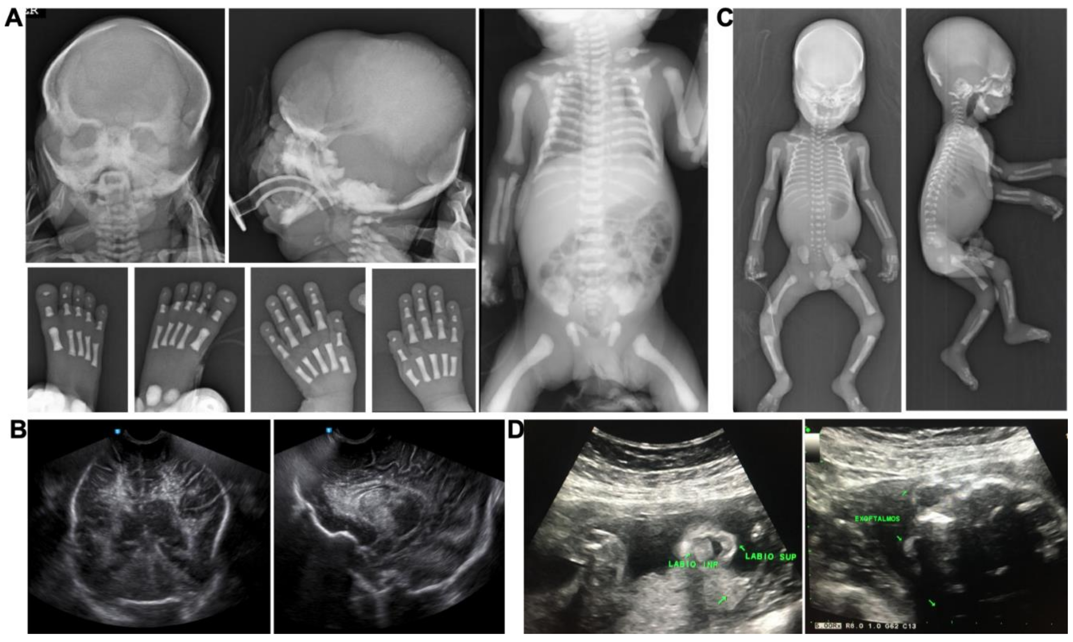Genes 11 00222 g002 Genes 11 00222 g002