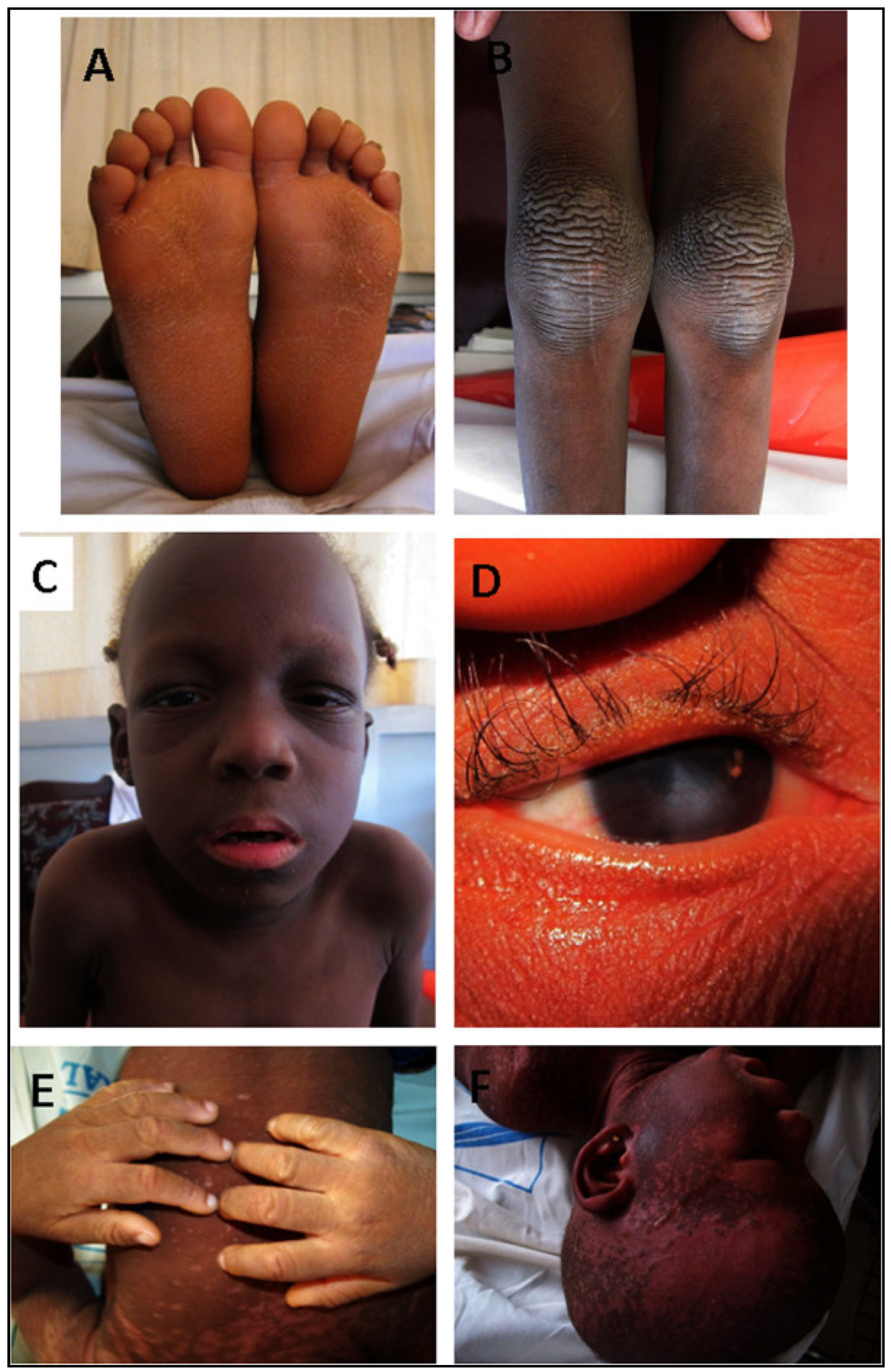 Genes 11 00233 g003 Genes 11 00233 g003