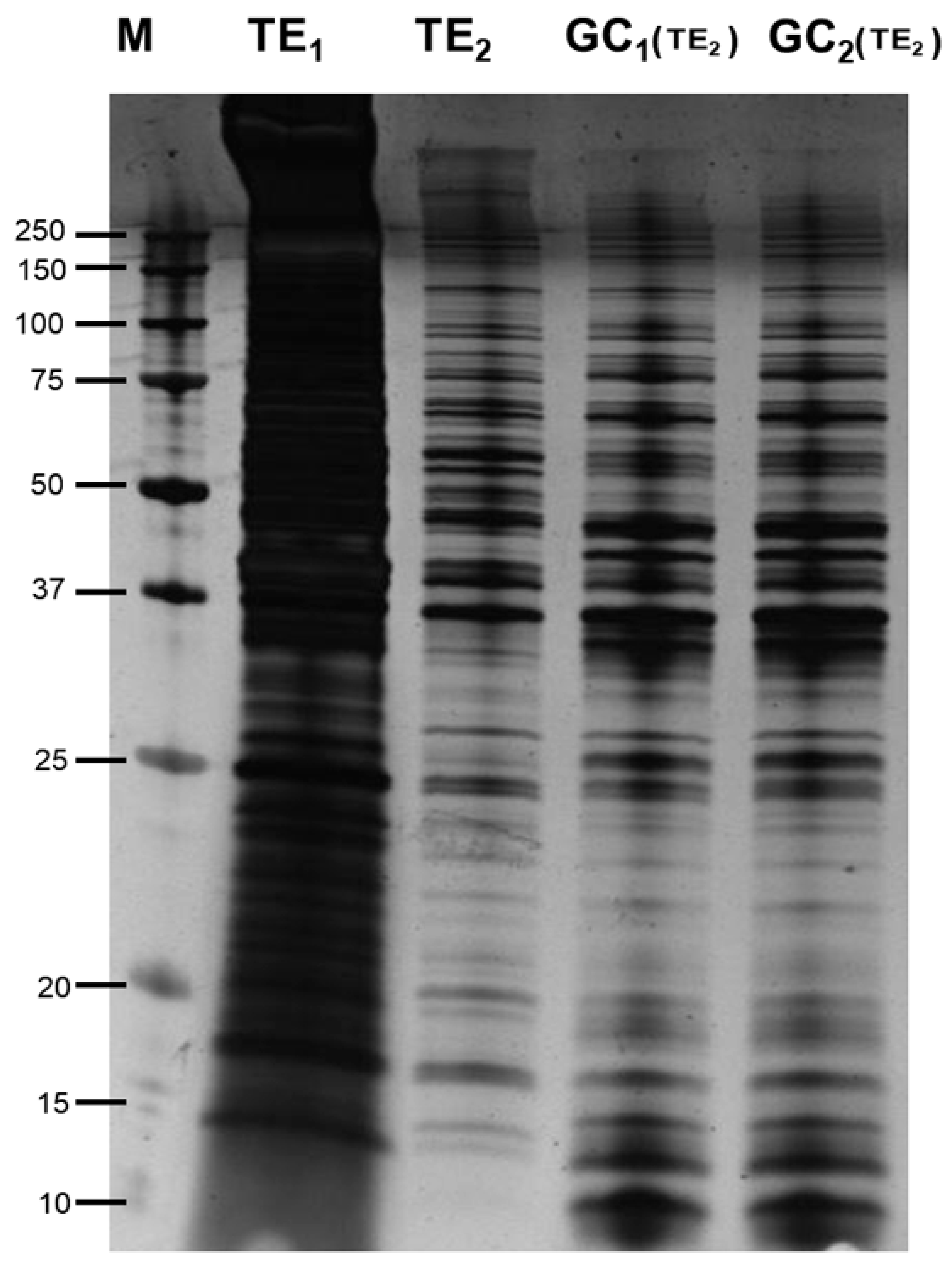 Genes Free Full Text Immunoreactive Proteins In The Esophageal Gland Cells Of Anisakis Simplex Sensu Stricto Detected By Maldi Tof Tof Analysis Html Genes Free Full Text Immunoreactive Proteins In The Esophageal Gland Cells Of Anisakis Simplex Sensu Stricto Detected By Maldi Tof Tof Analysis Html