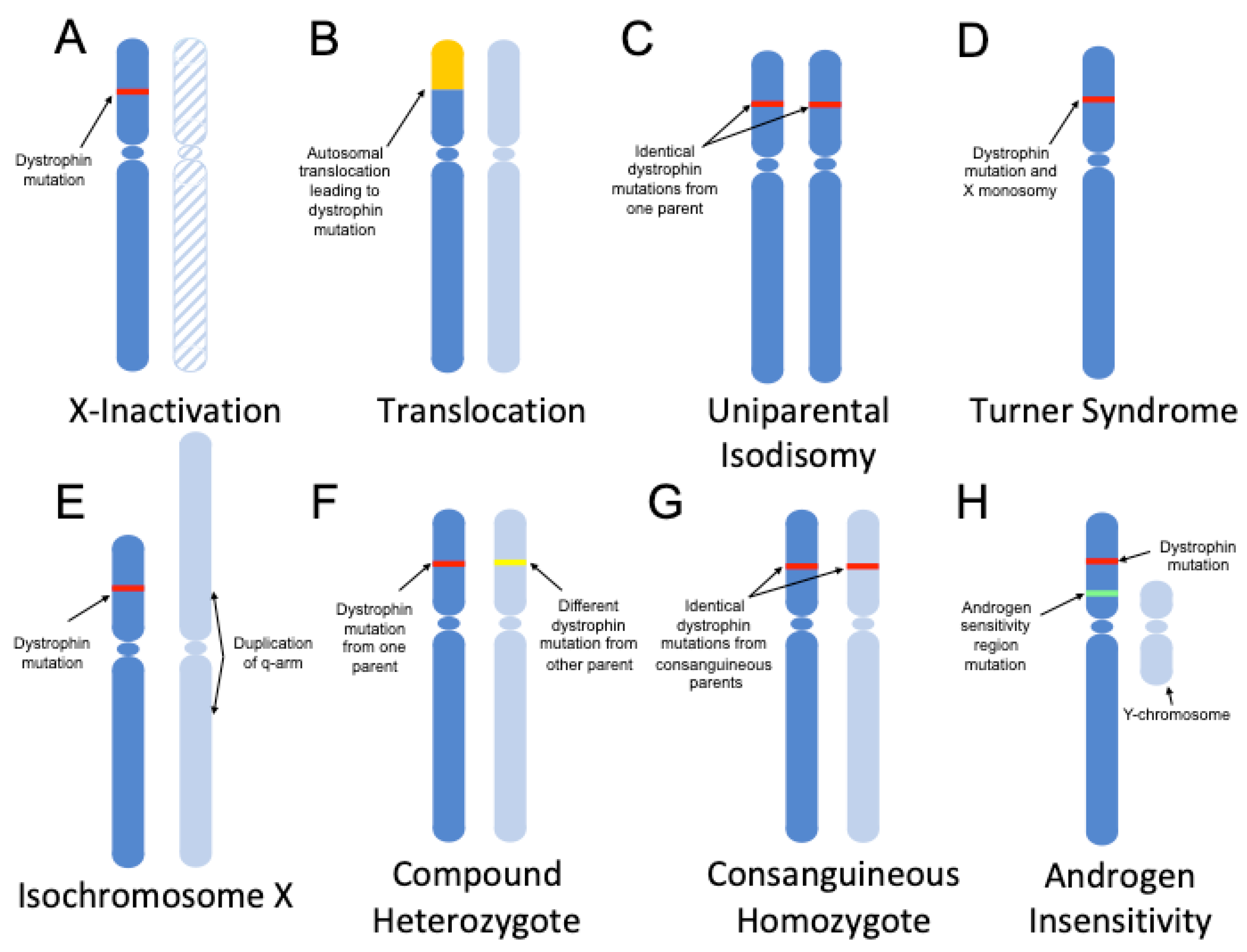 Genes Free Full Text Cardiac Involvement In Dystrophin Deficient Females Current Understanding And Implications For The Treatment Of Dystrophinopathies Html Genes Free Full Text Cardiac Involvement In Dystrophin Deficient Females Current Understanding And Implications For The Treatment Of Dystrophinopathies Html