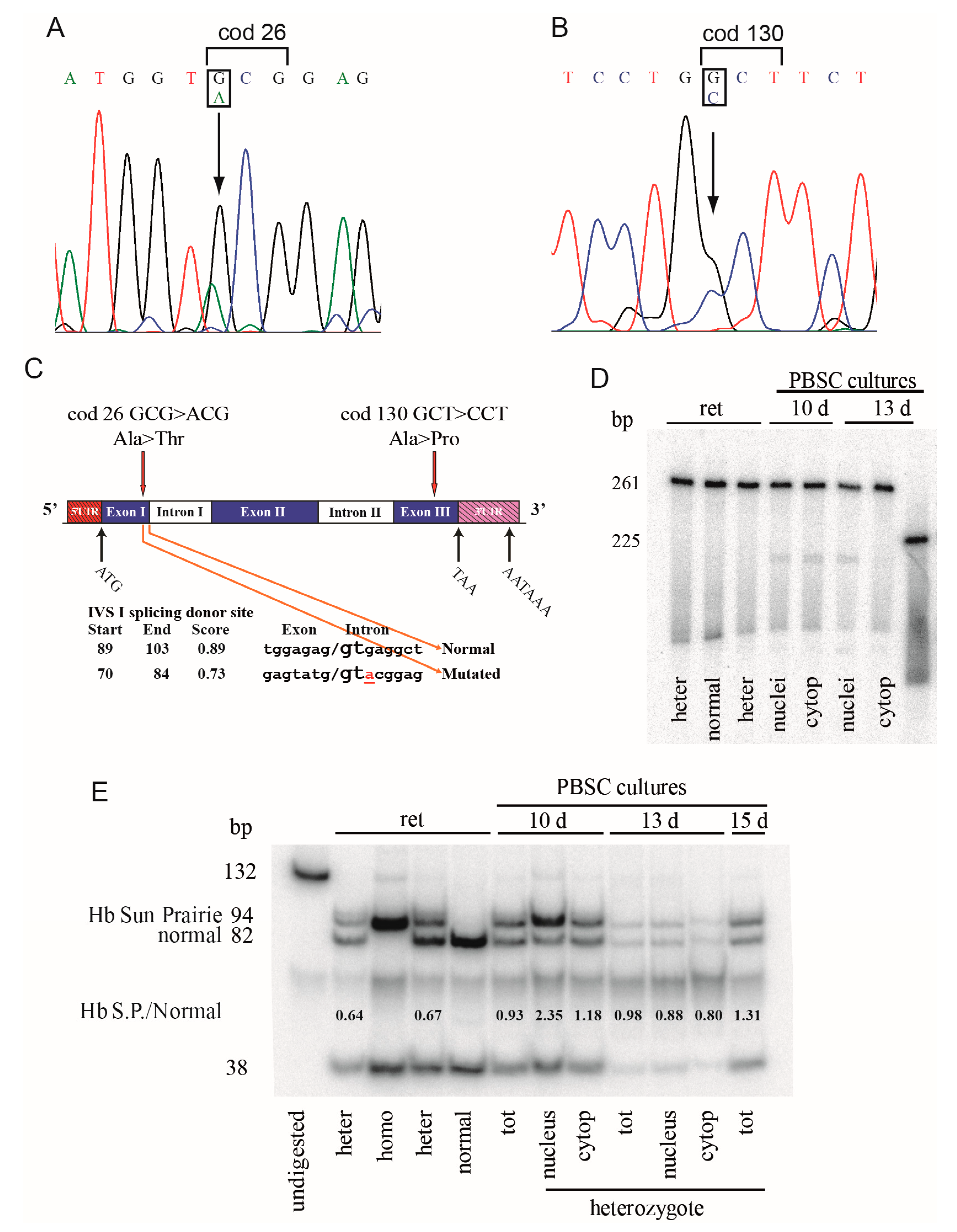 Genes Free Full-Text Effect of Mutations on mRNA and Globin Stability The Cases of Hb Bernalda/Groene Hart and Hb Southern Italy