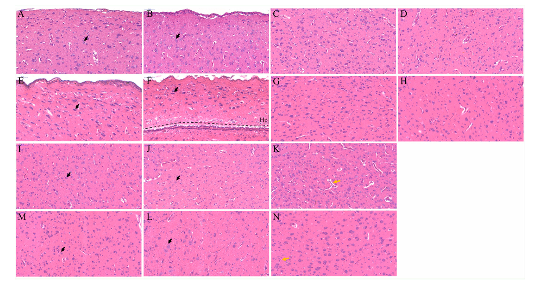 Genes 11 01008 g003