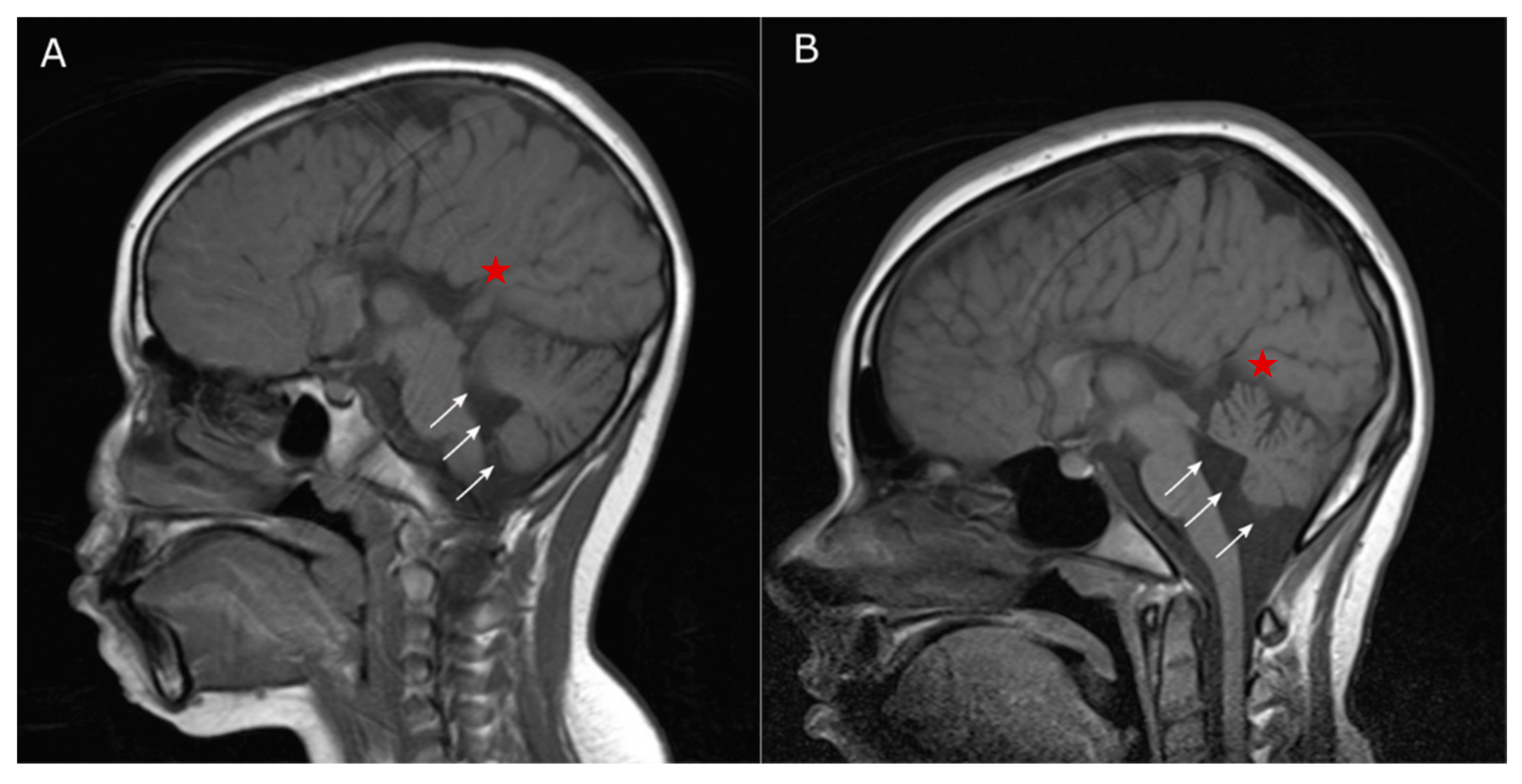 Genes 11 01028 g003 Genes 11 01028 g003