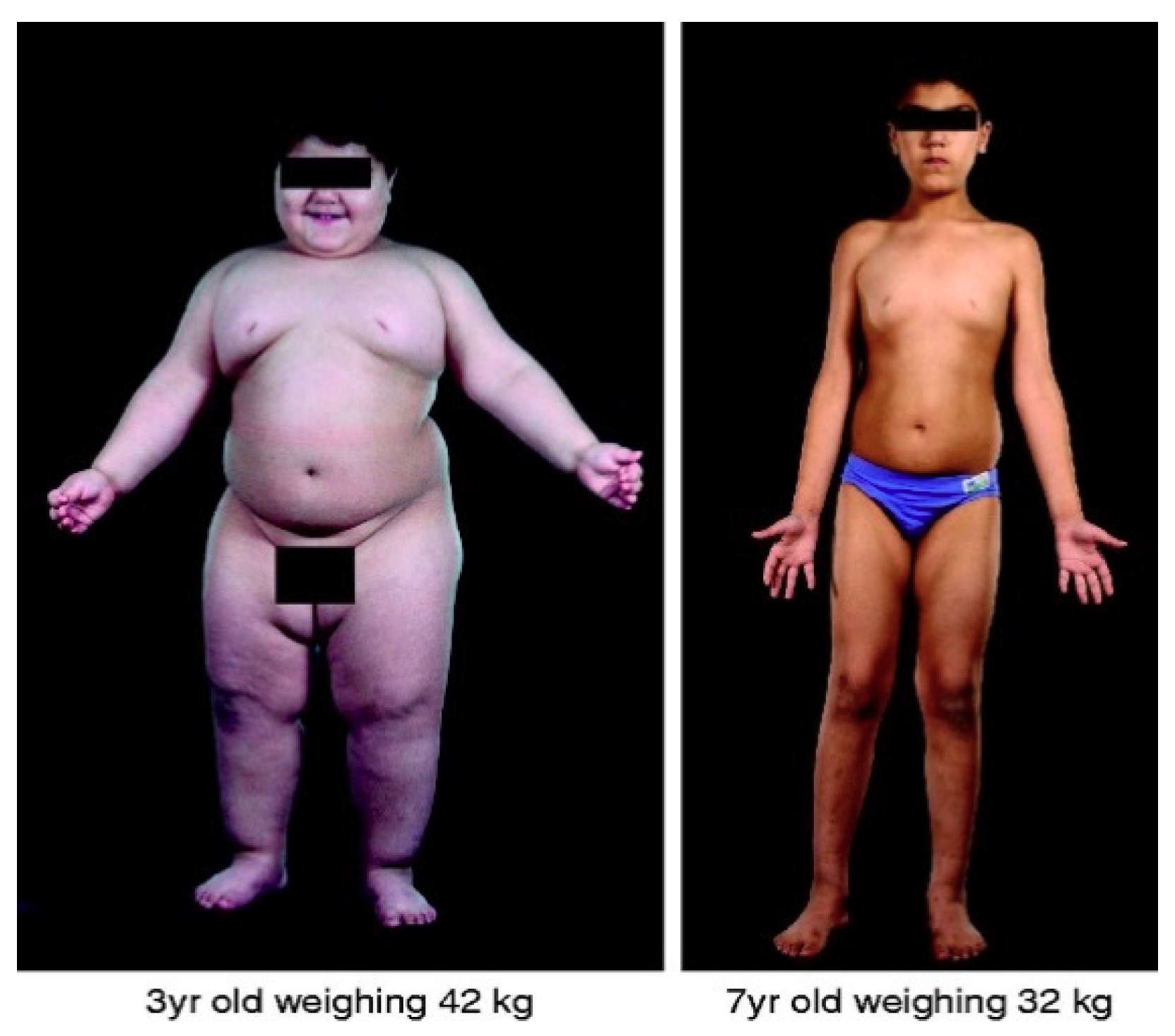 Genes 11 01378 g001 Genes 11 01378 g001