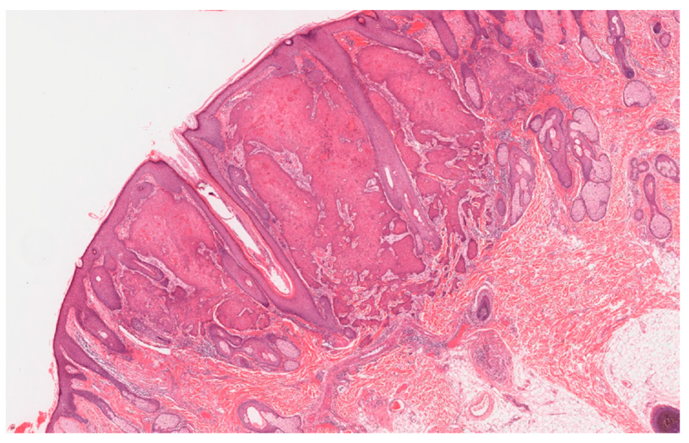 Genes 11 01410 g002